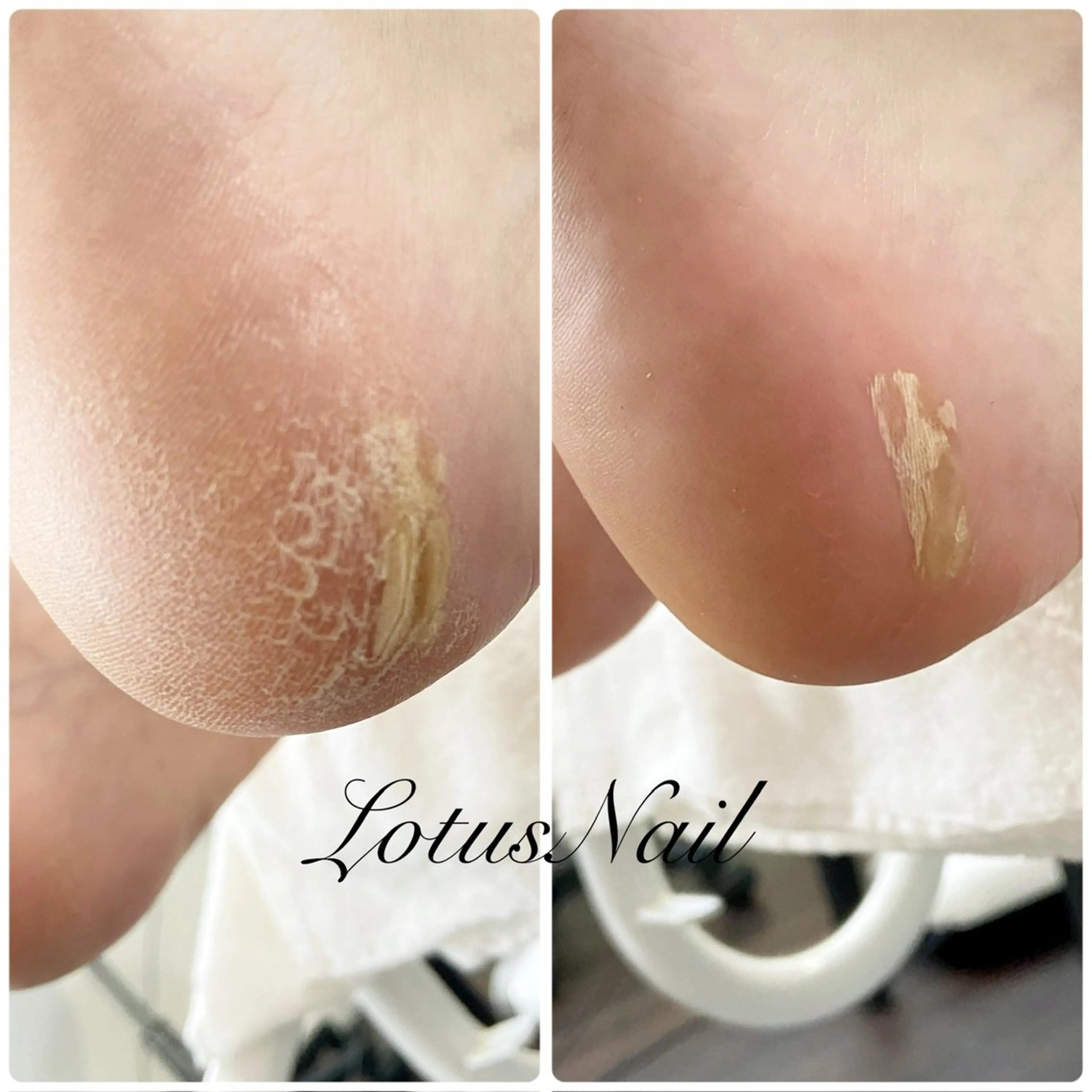 ネイル フットネイル Lotus Nailのネイルデザイン