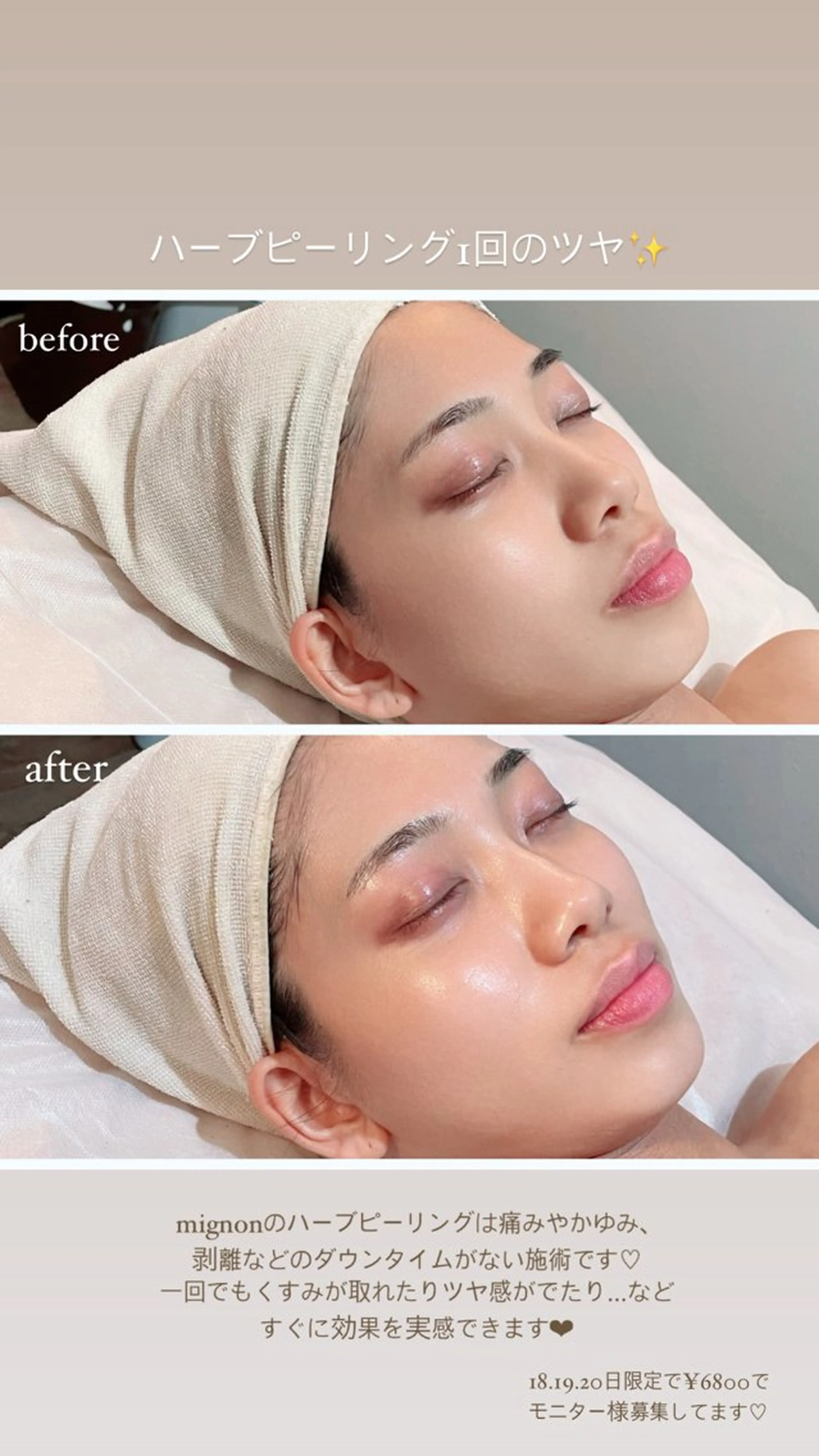 mignon /まつげパーマ/眉毛のエステ・リラクイメージ