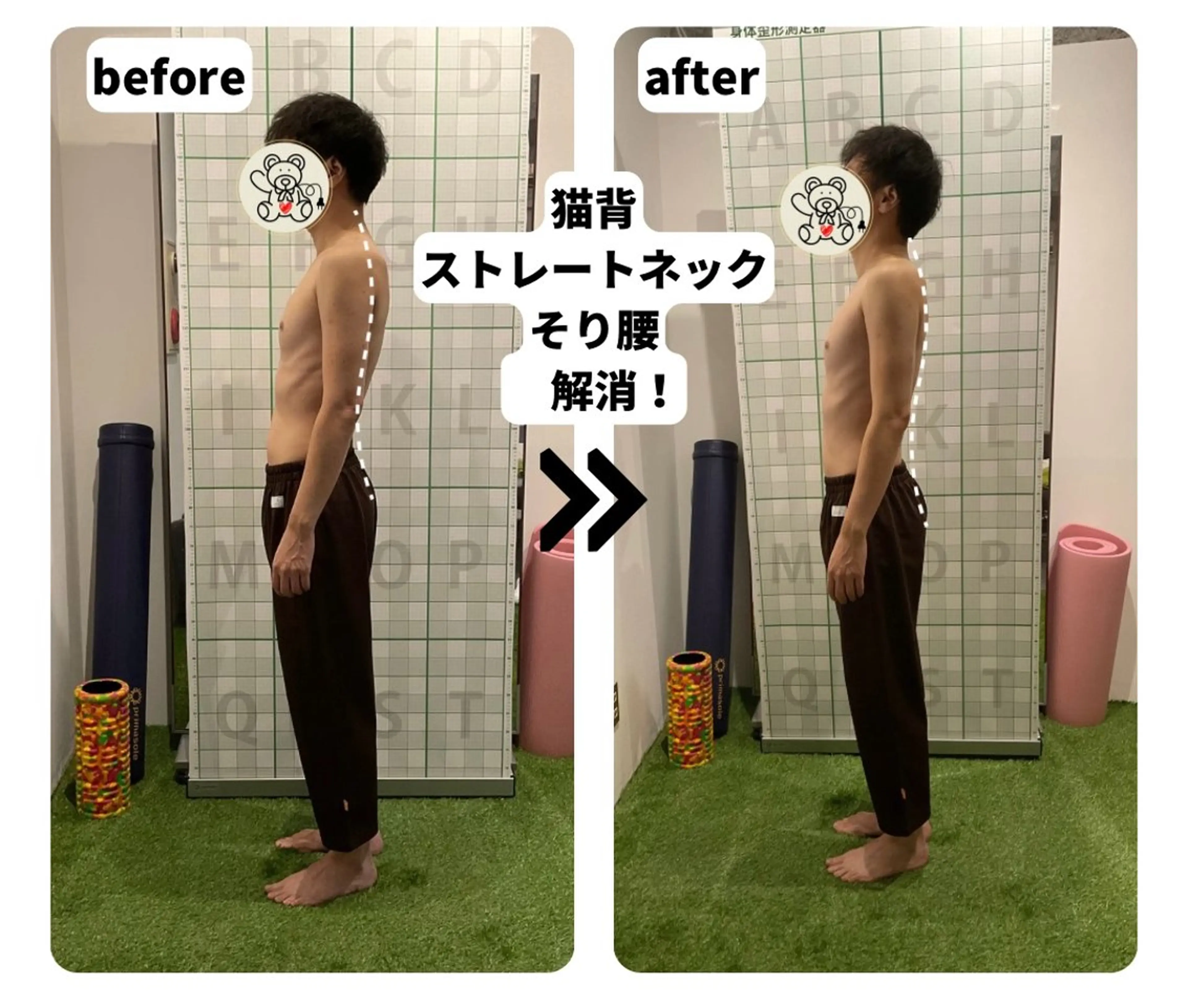 【初回限定40%OFF】ラジオ波美容全身整体💆引き締め/ゆがみ/むくみ/【ストレートネック/猫背/腰/骨盤/脚】の写真