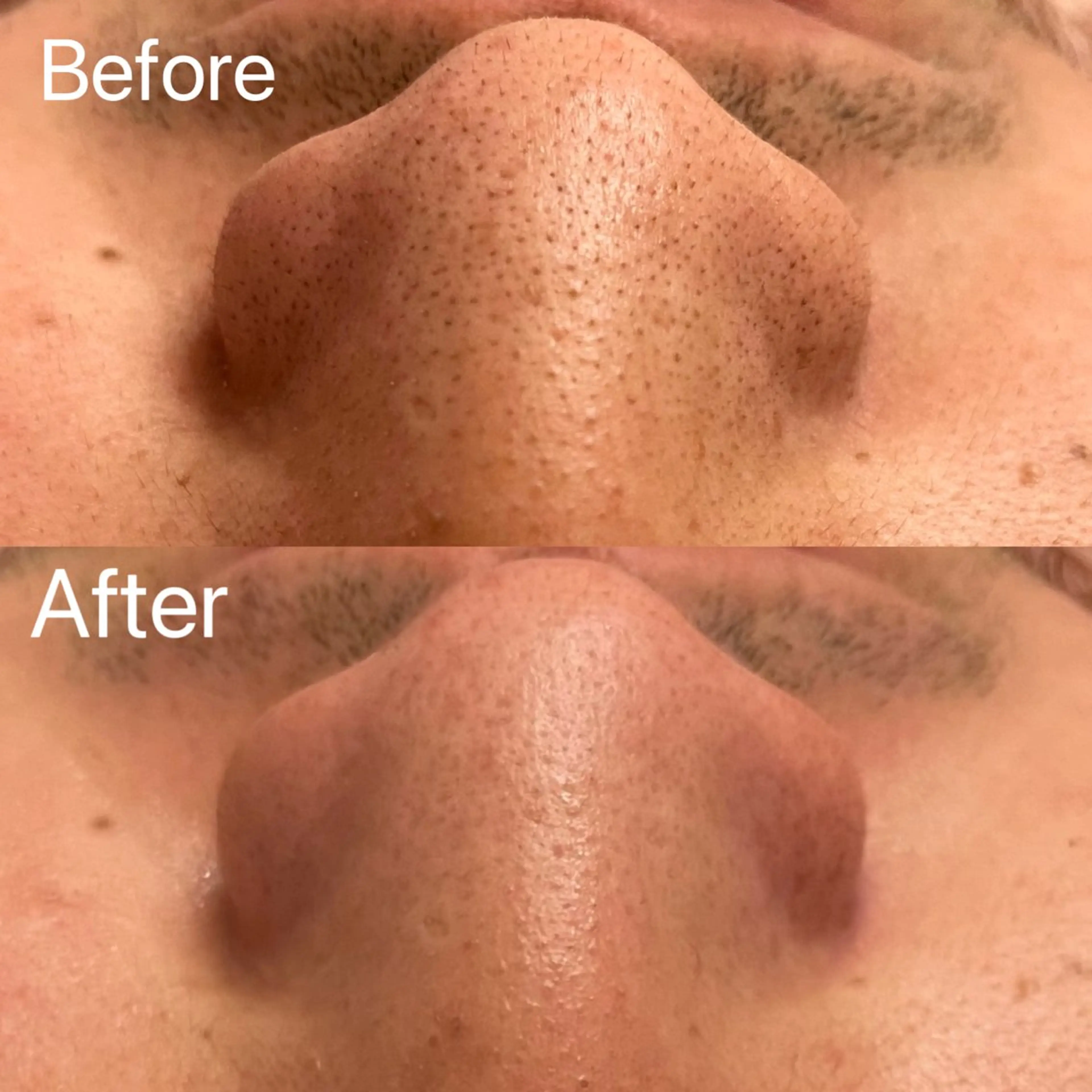 エステ アイラッシュ&エステサロンLinda西宮所属・小顔&毛穴・肌質改善 LINDA西宮 AIのエステ・リラクイメージ