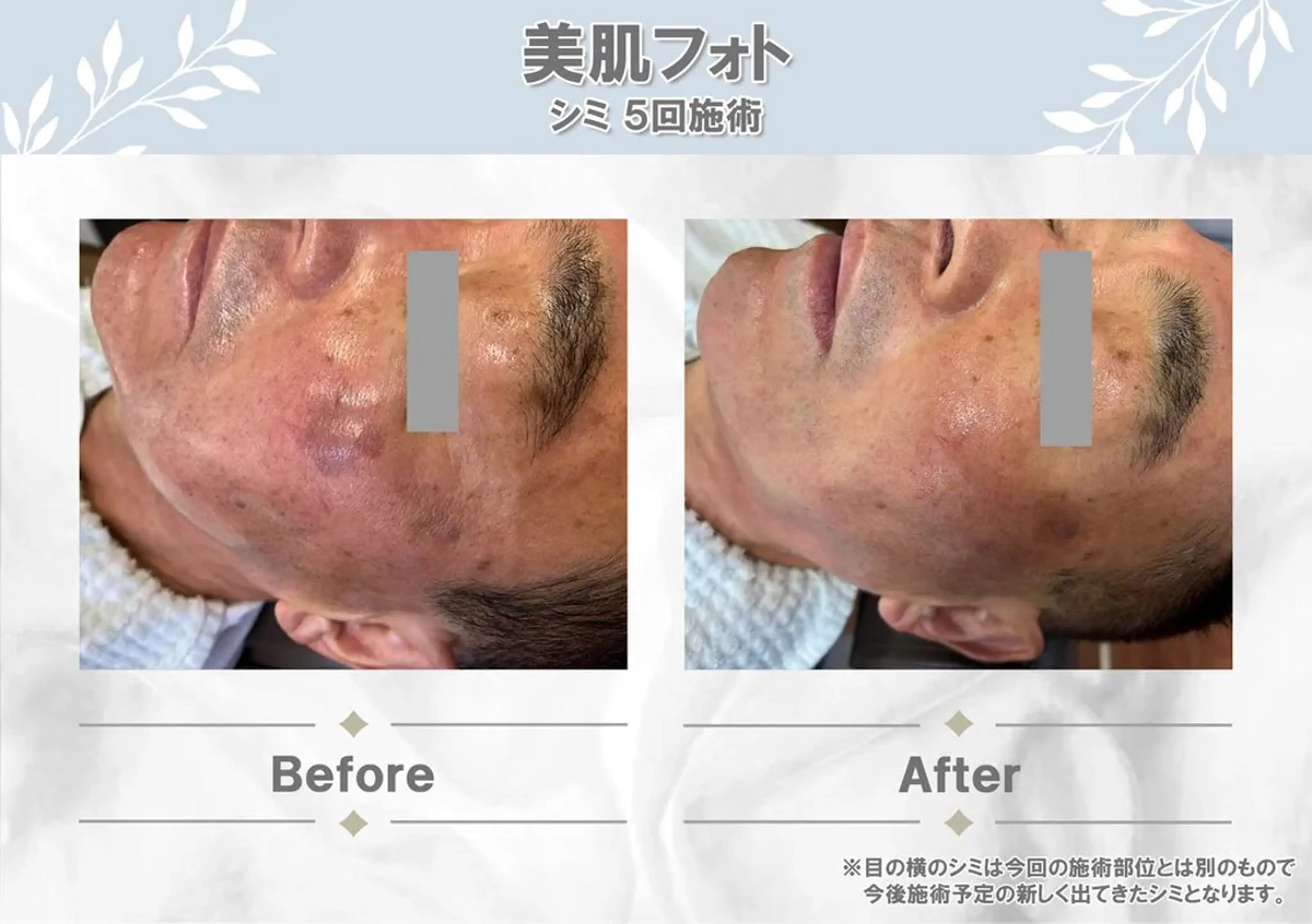 メンズ エステ MODE K's 白石彩夏のエステ・リラクイメージ