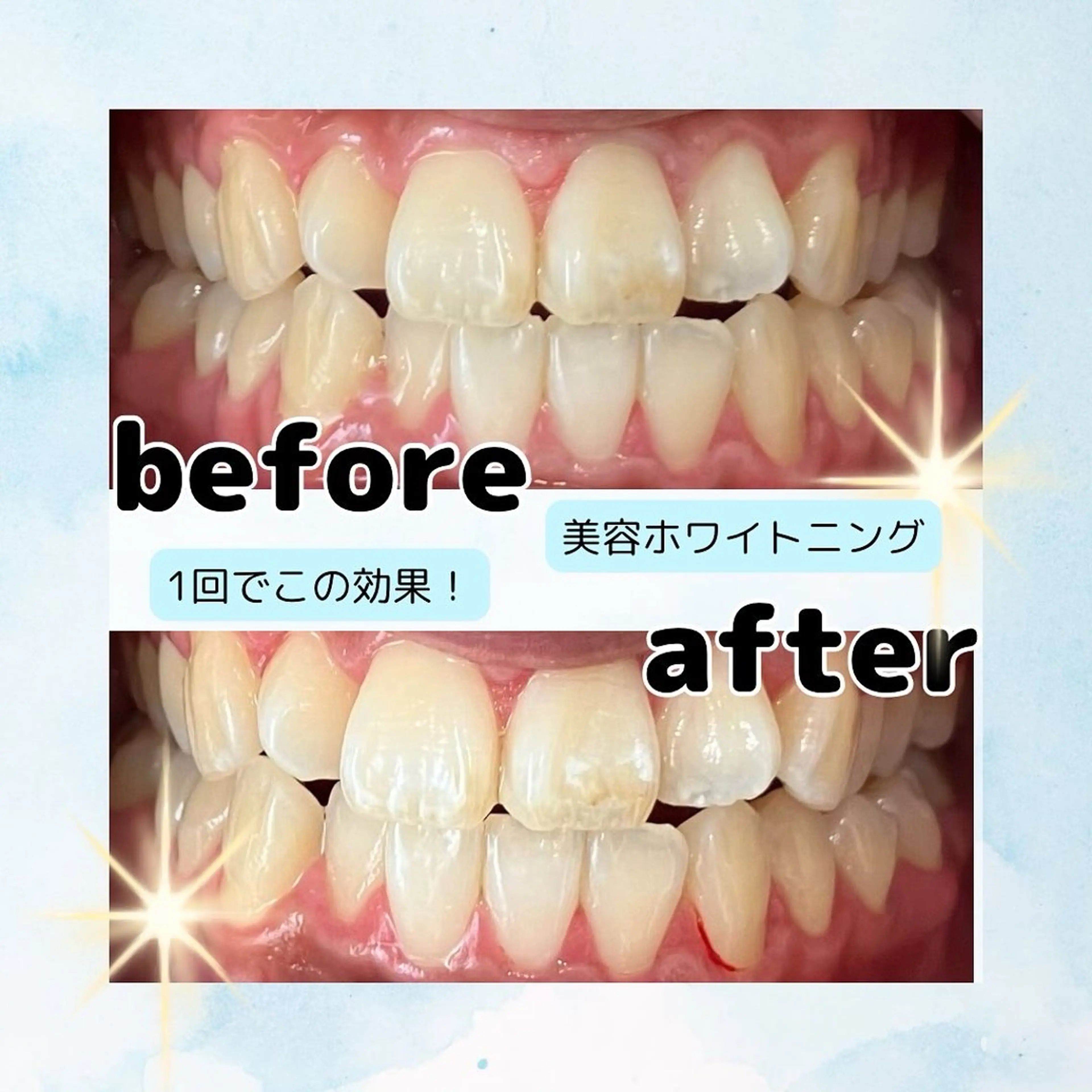 ホワイトニングサロン Soleilのその他イメージ