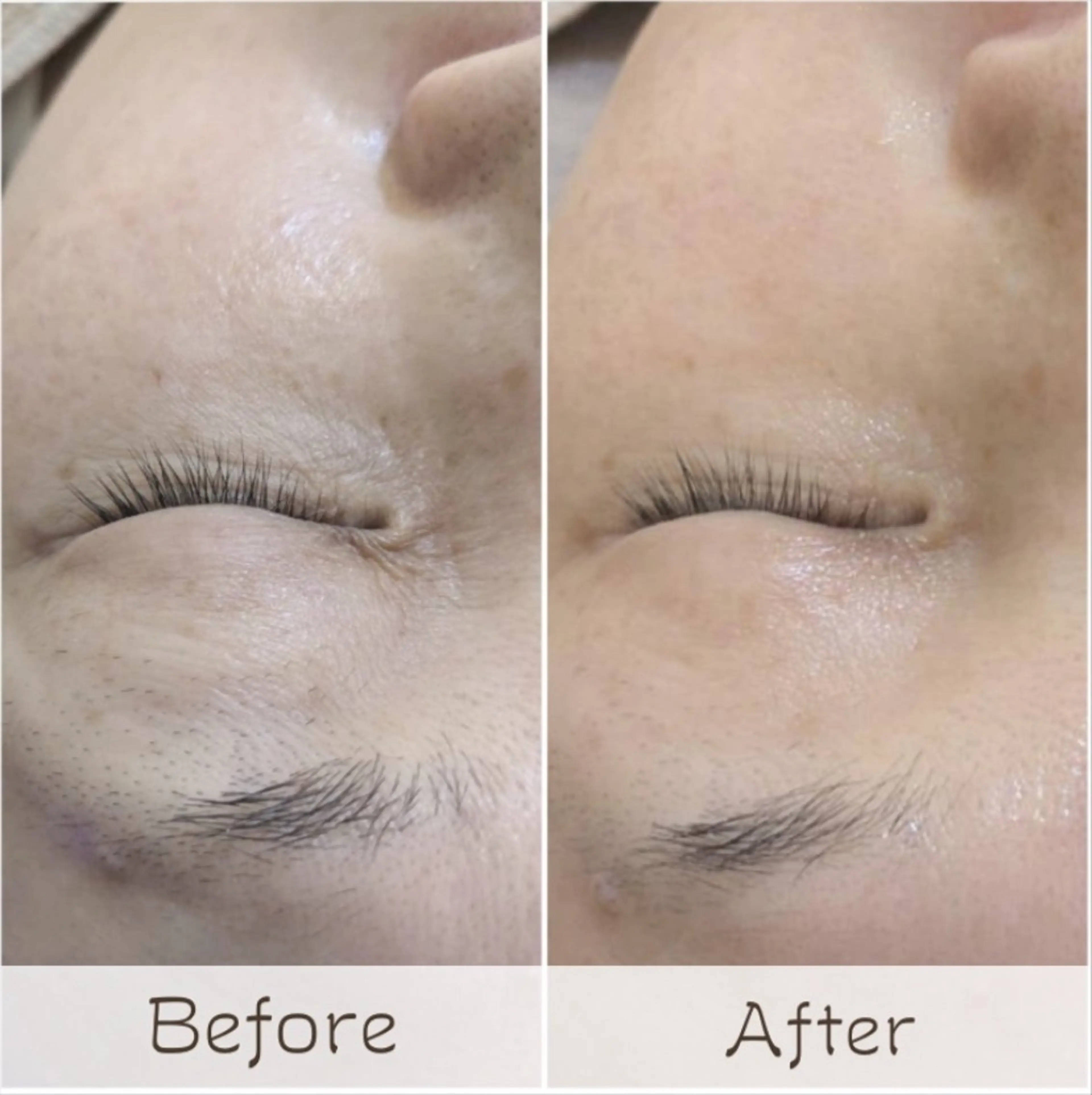 フェイシャル/毛穴 /シミ/たるみ東灘区のエステ・リラクイメージ