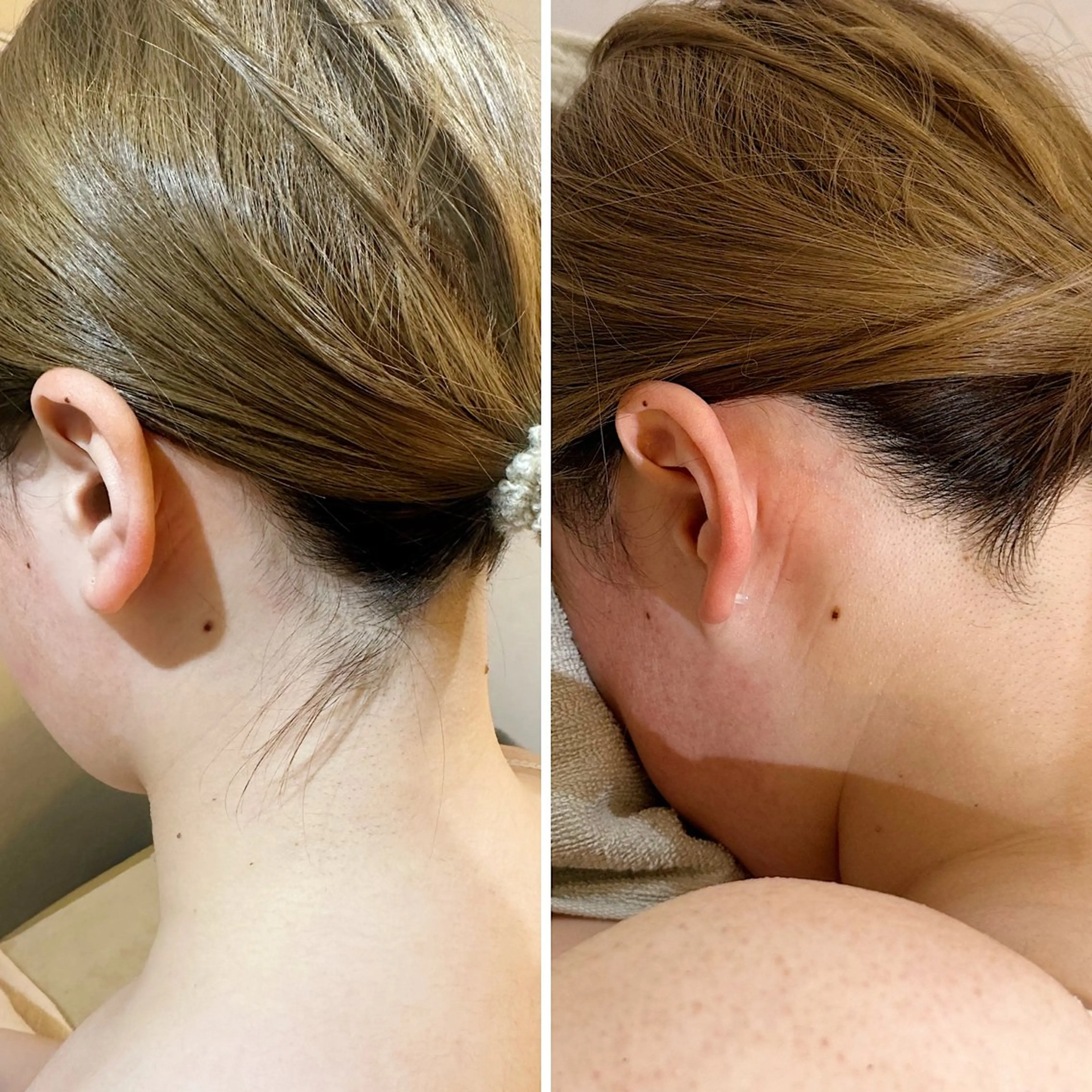 脱毛 うなじ脱毛/美肌脱毛 LABELのエステ・リラクイメージ