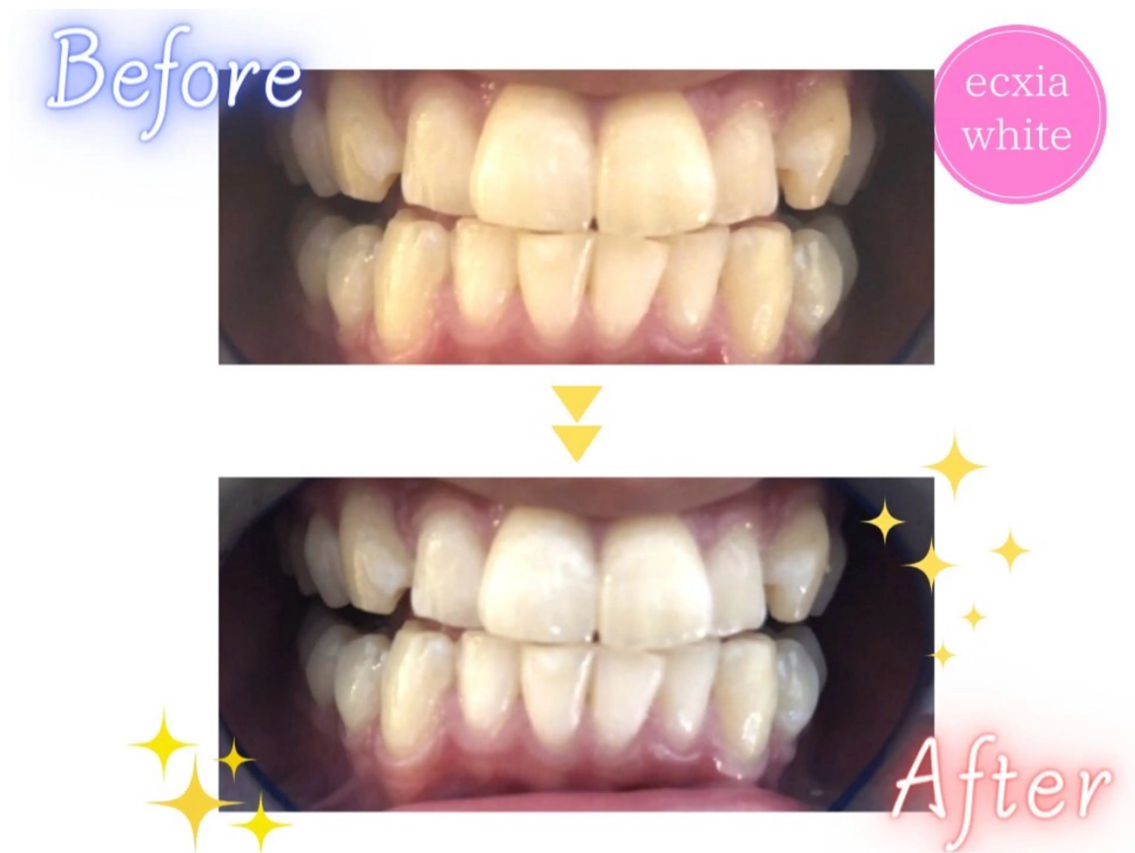 ecxia  white 　広島袋町店所属・セルフホワイトニング エクシア広島袋町店のその他イメージ