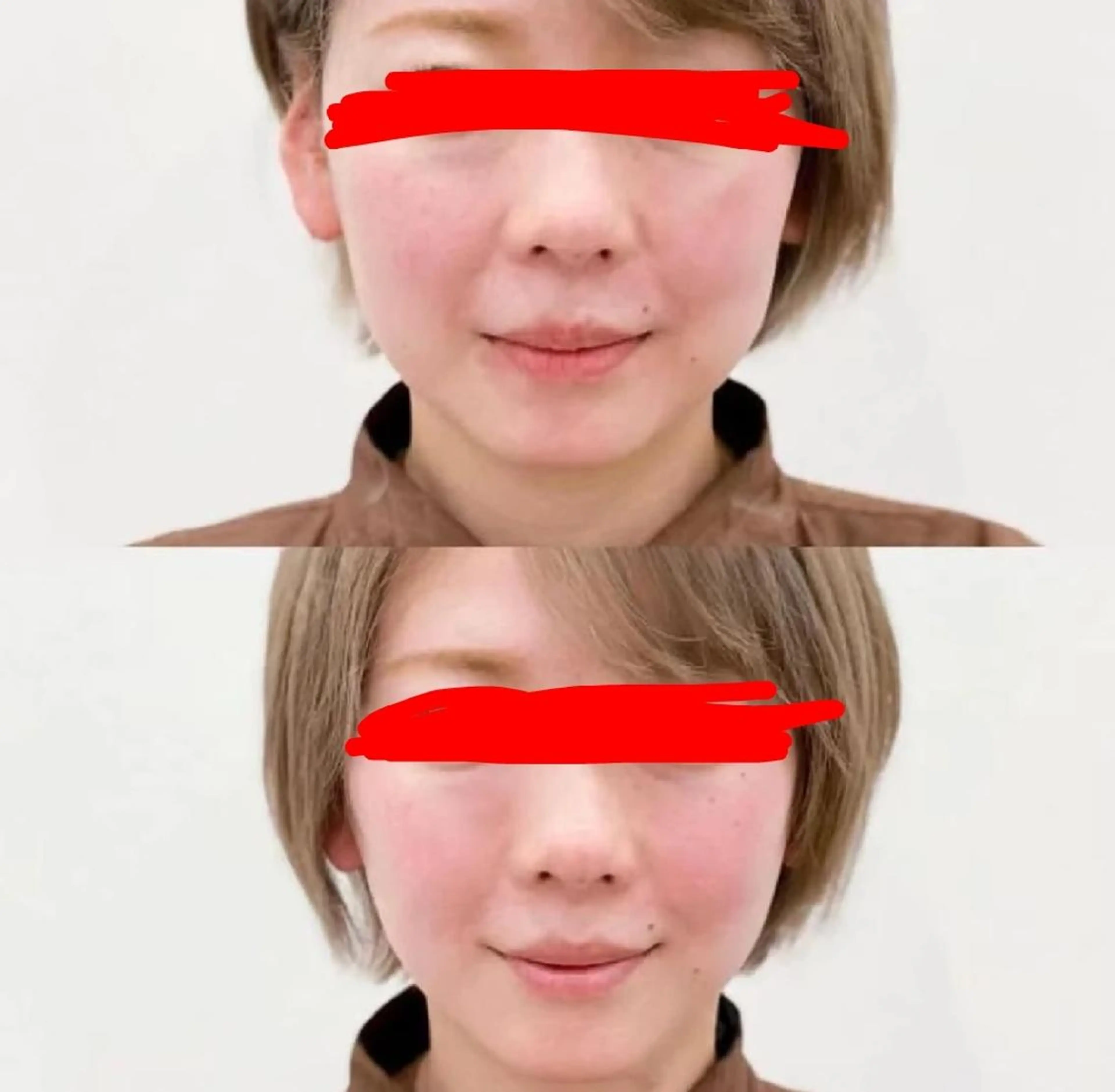 エステ aliaハイフ&水光ジェットサロン所属・aliaハーブ水光店 エステティシャン募集のエステ・リラクイメージ