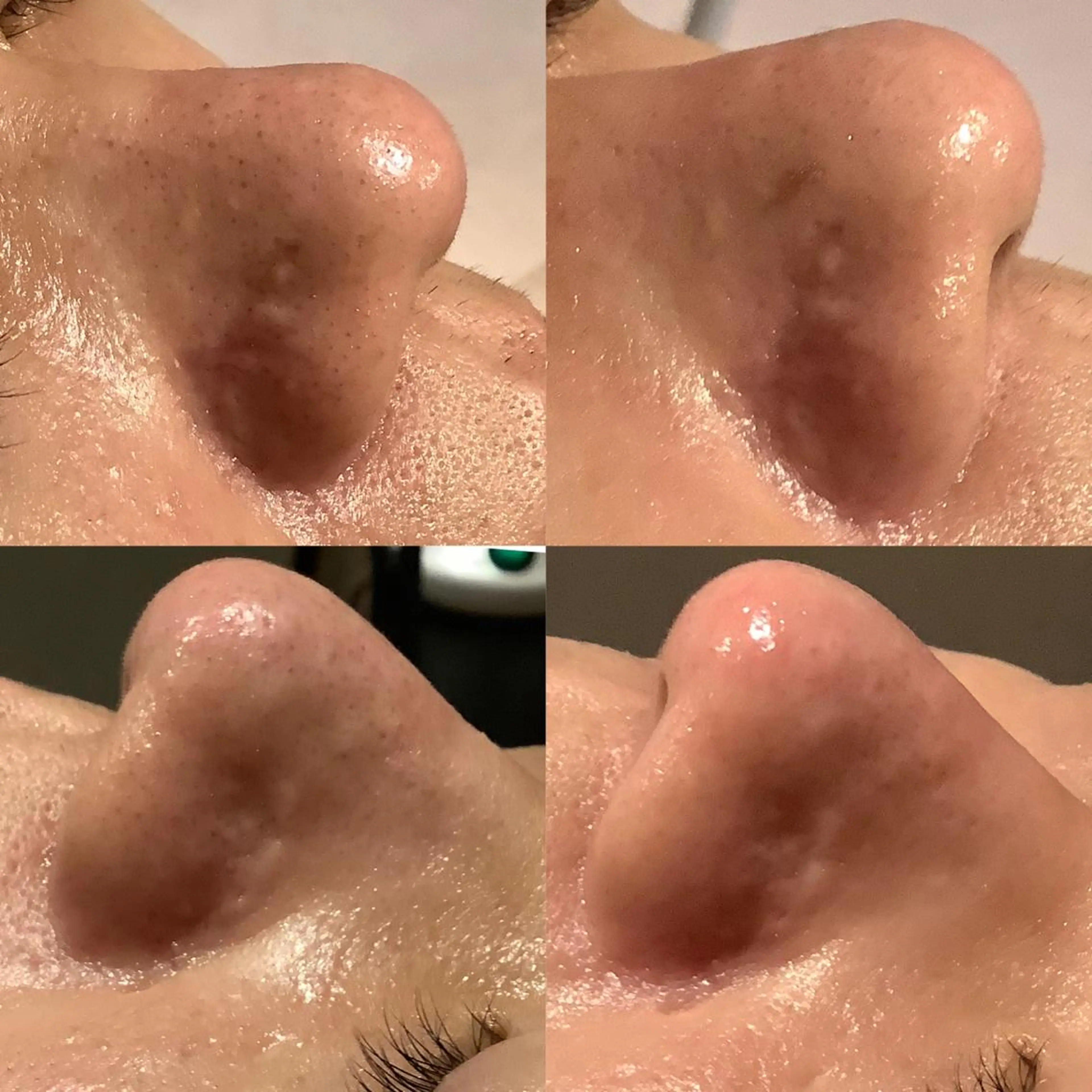 エステ 脱毛&エステサロン JIGGLY武蔵小山のエステ・リラクイメージ