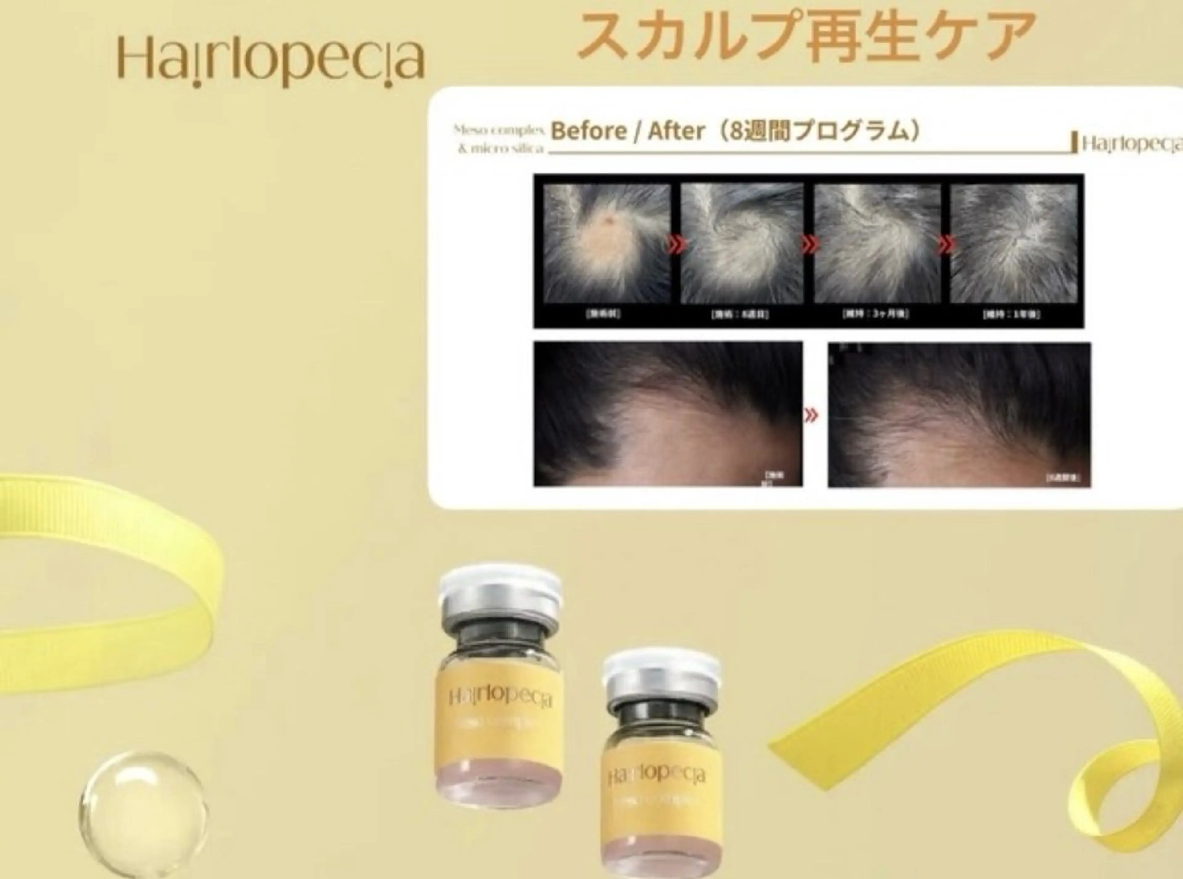 最新スカルプ再生ケア✨頭皮マッサージ＋スピキュール導入1ヶ月ホームケア付きの写真