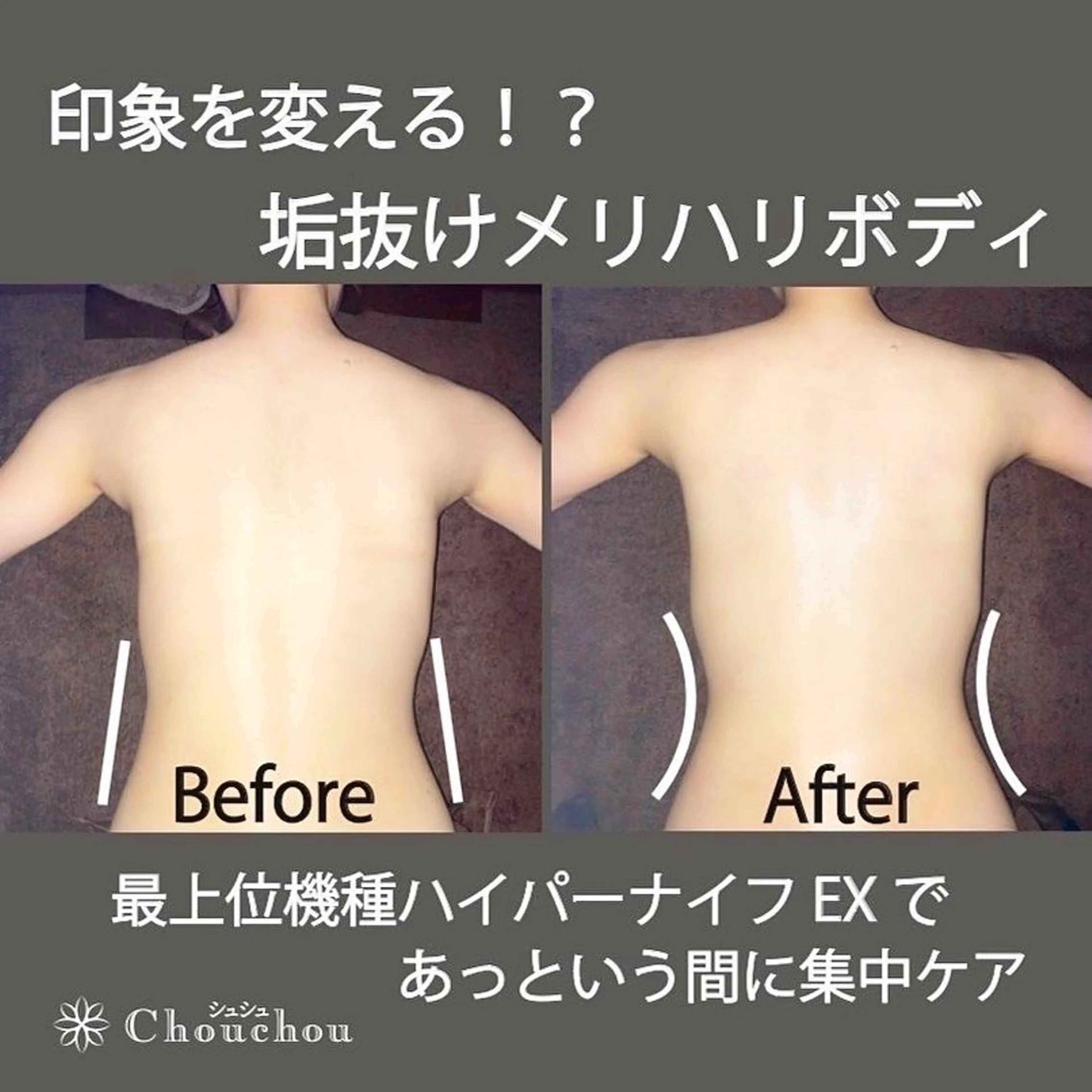 メンズ 痩身・小顔・美肌専門 Chou chouのエステ・リラクイメージ