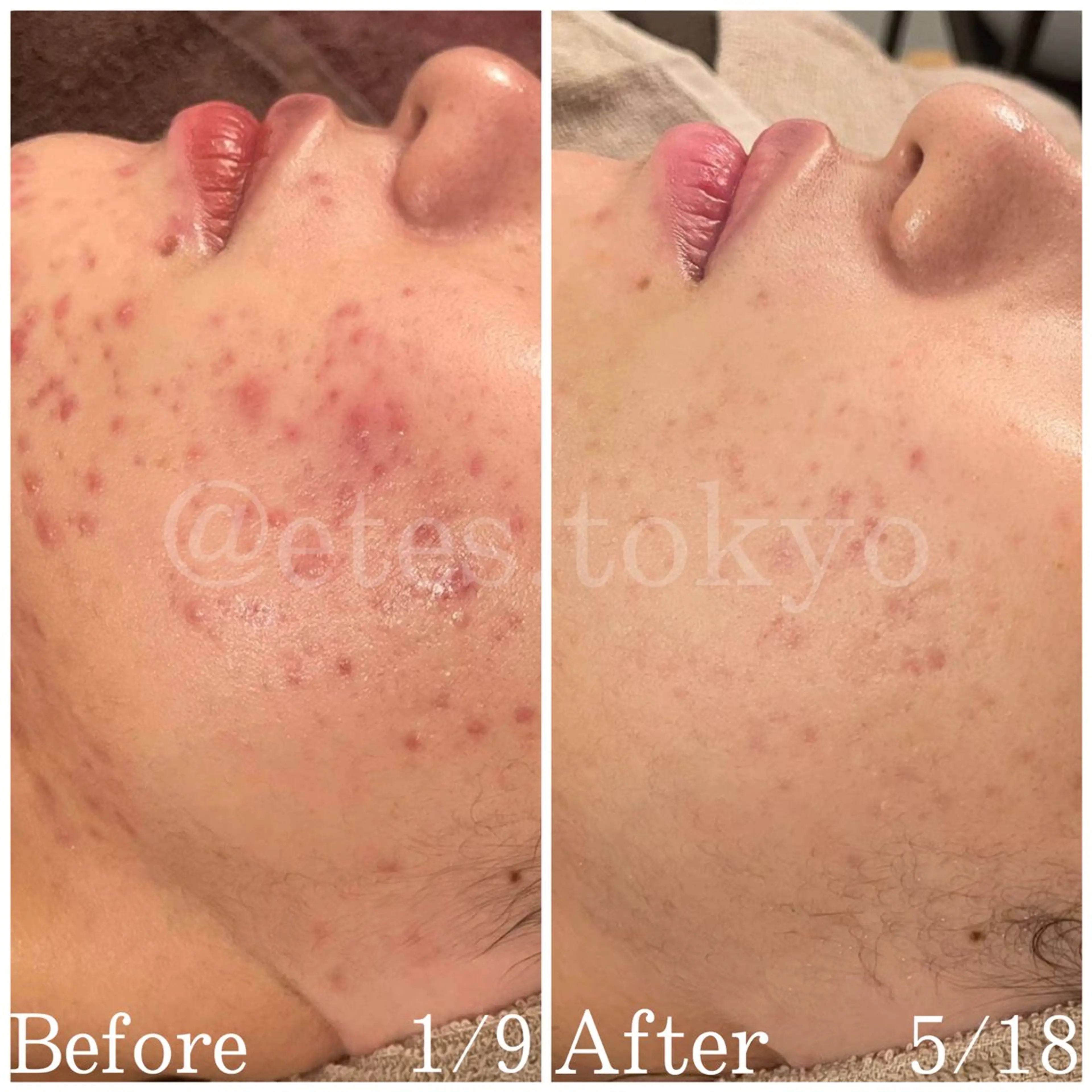 etes （エトエス）所属・etes.tokyo 中目黒のエステ・リラクイメージ