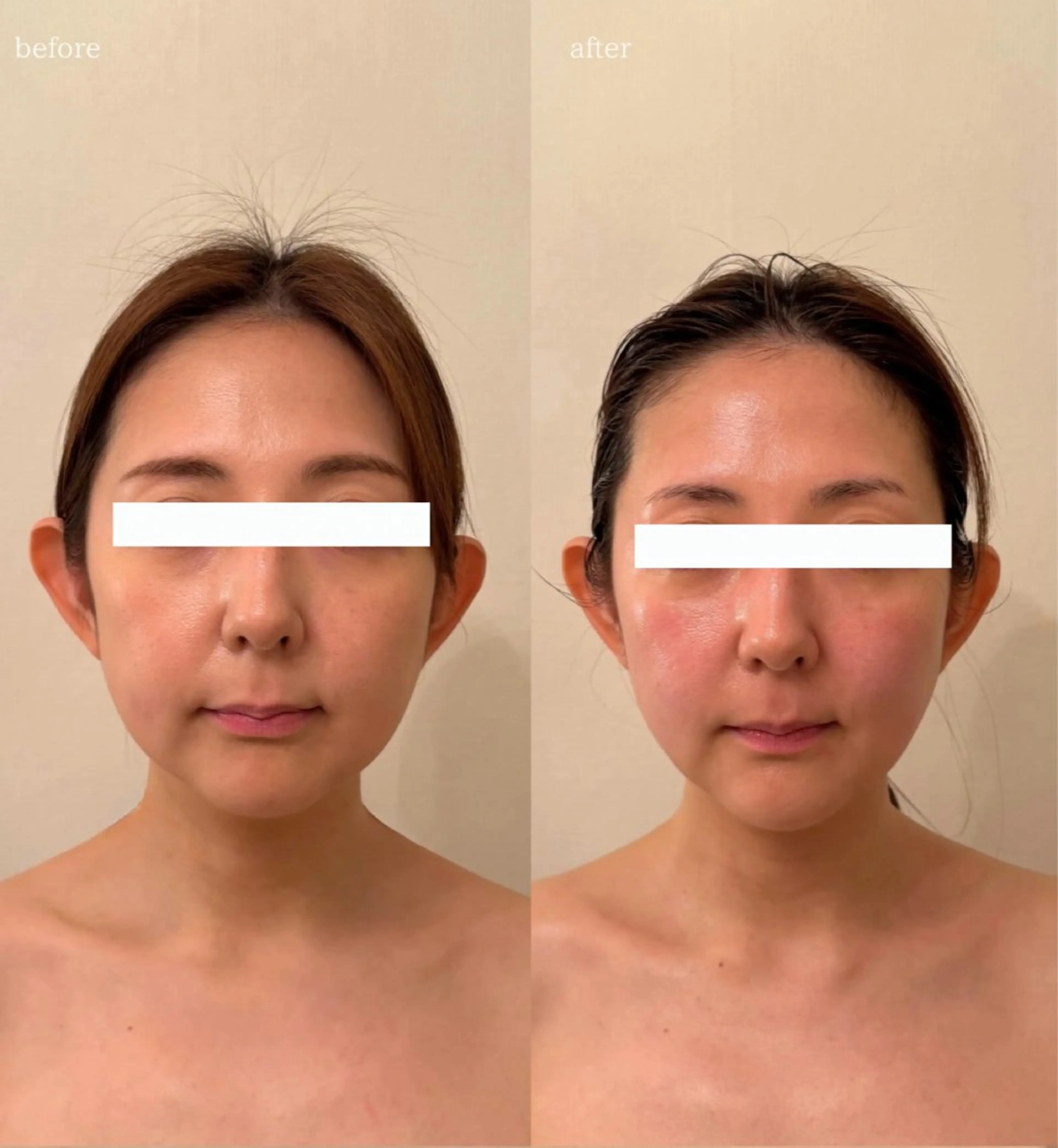 エステ 小顔×痩身専門サロンCLORE浦和店所属・石川 彩花のエステ・リラクイメージ