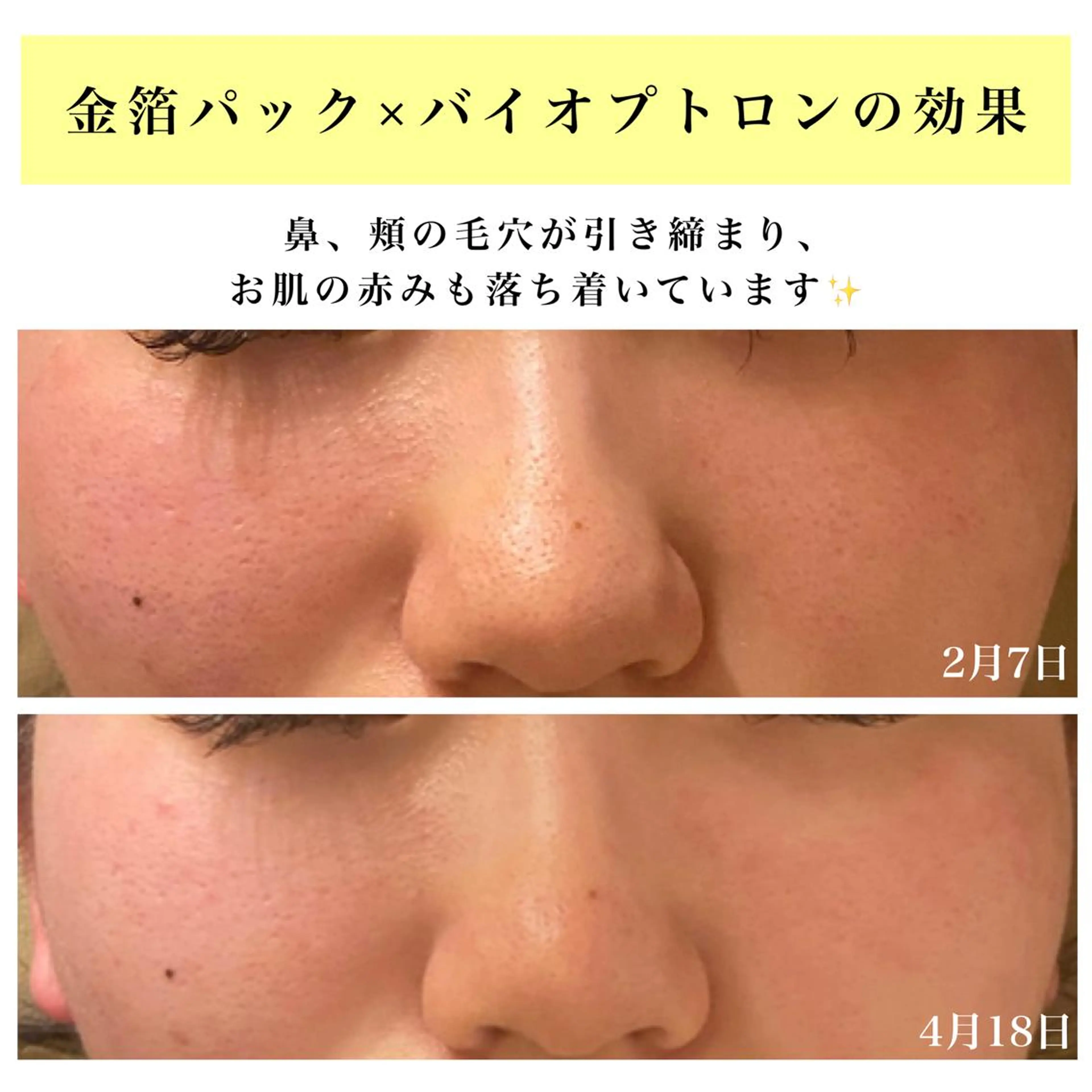 エステ リラク Bellesthe （ベルエステ）のエステ・リラクイメージ