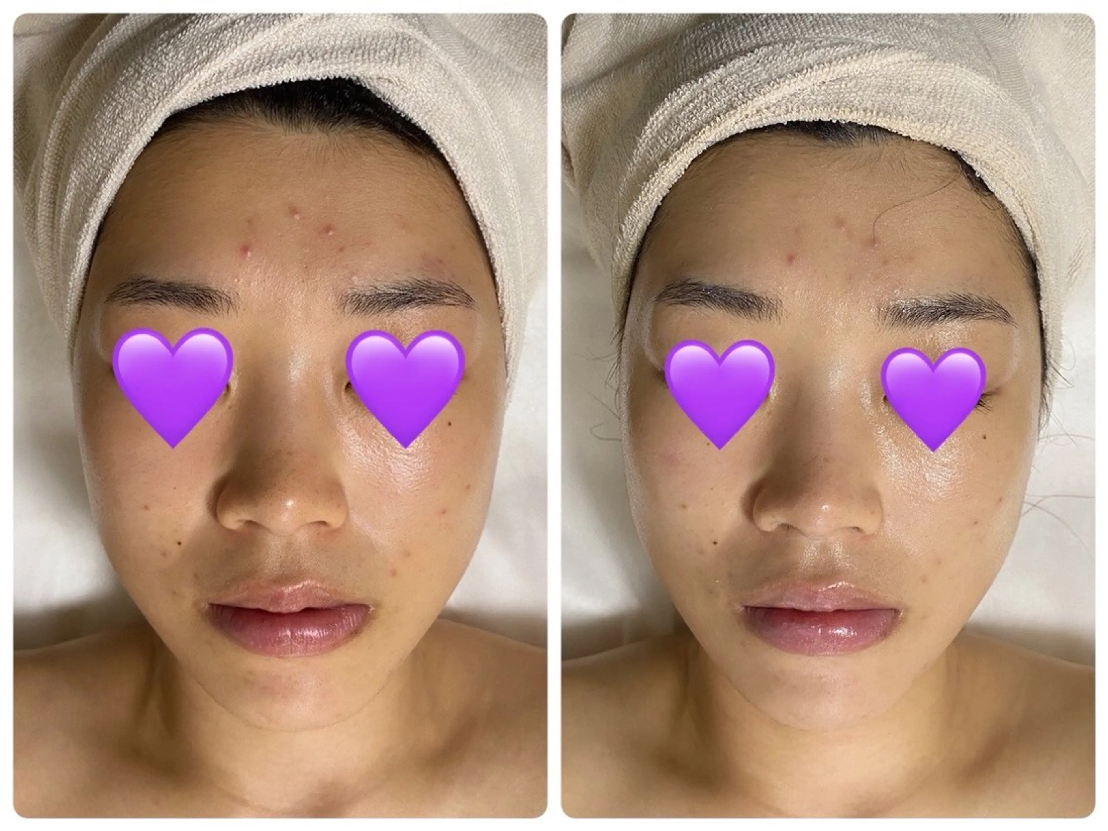 De I'm トータルビューティーサロン所属・COCO beautyサロンのエステ・リラクイメージ