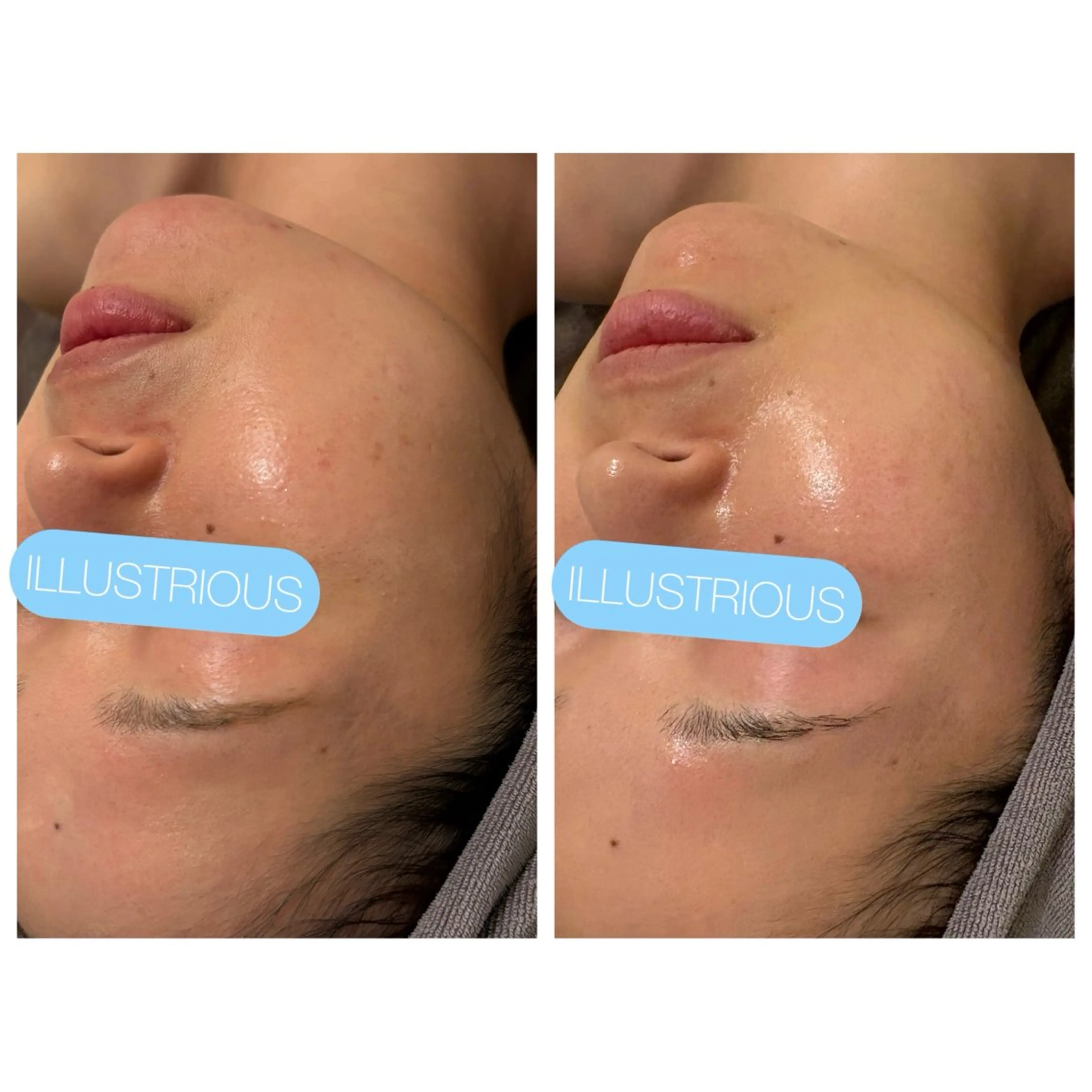 ☆痩身/小顔☆ コルギのエステ・リラクイメージ