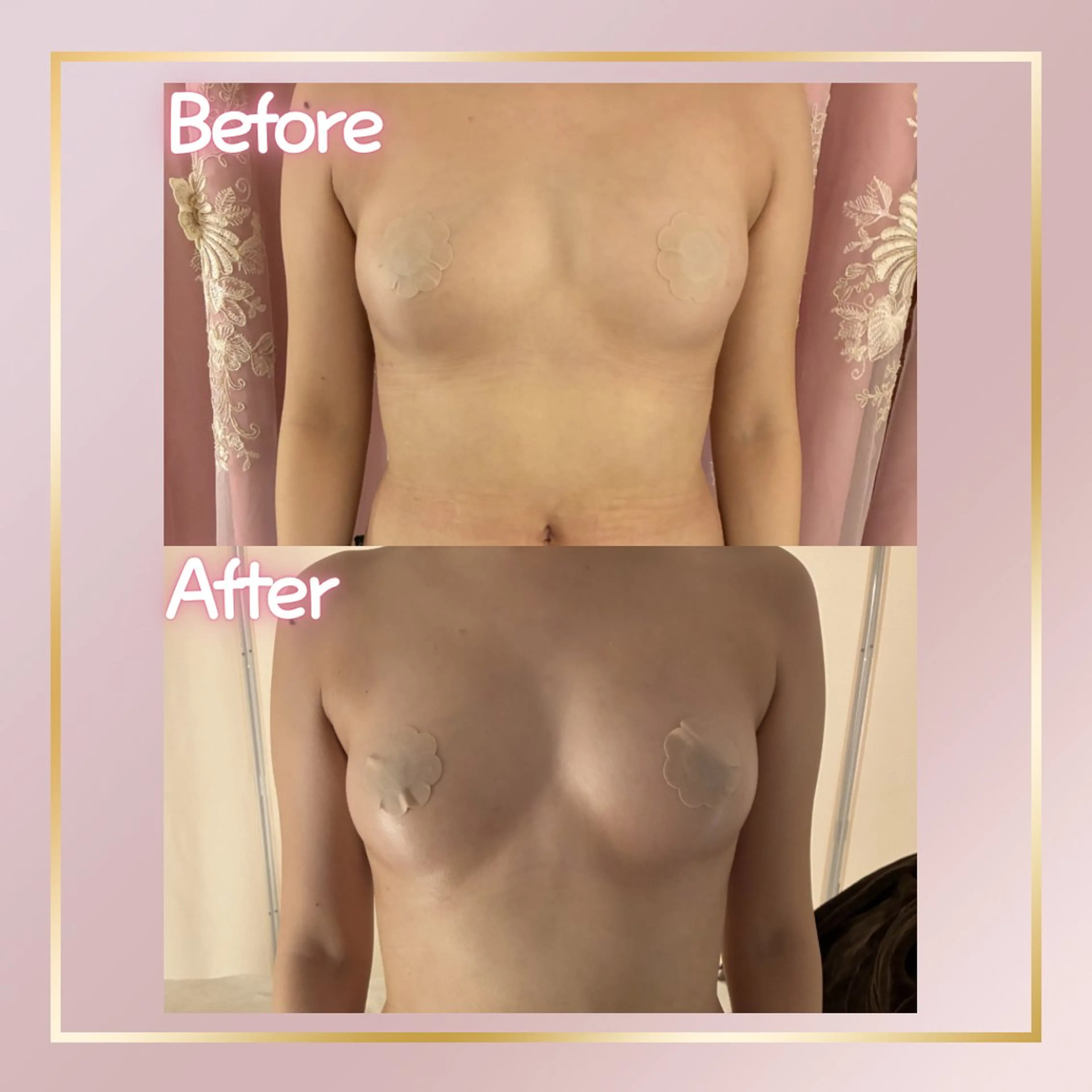 その他 ROSALIA 【バストアップ、痩身、毛穴洗浄】所属・【24時まで営業】 バストアップ専門店のエステ・リラクイメージ