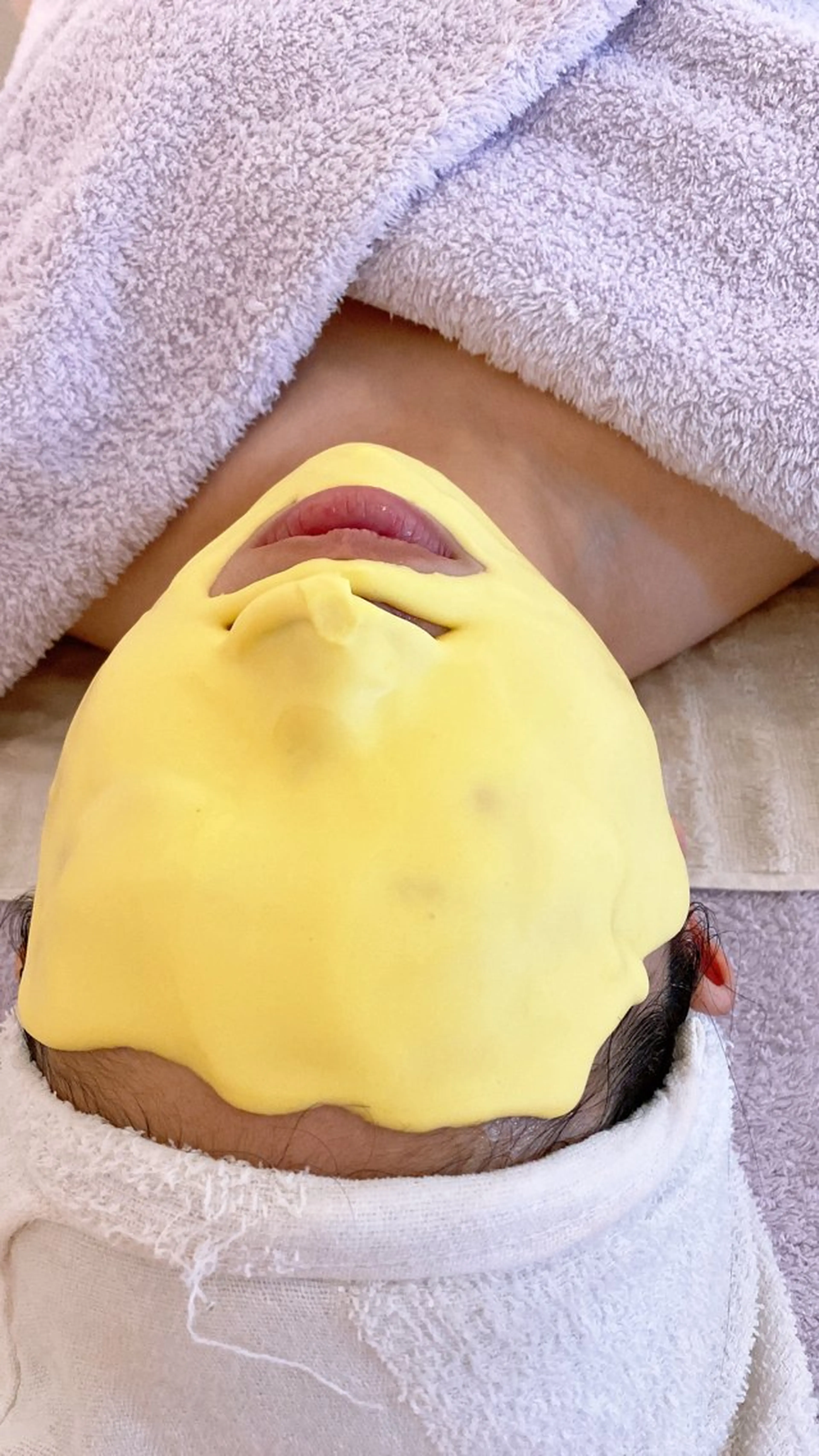 アドバンスコース➕ダブルビタQパックの写真