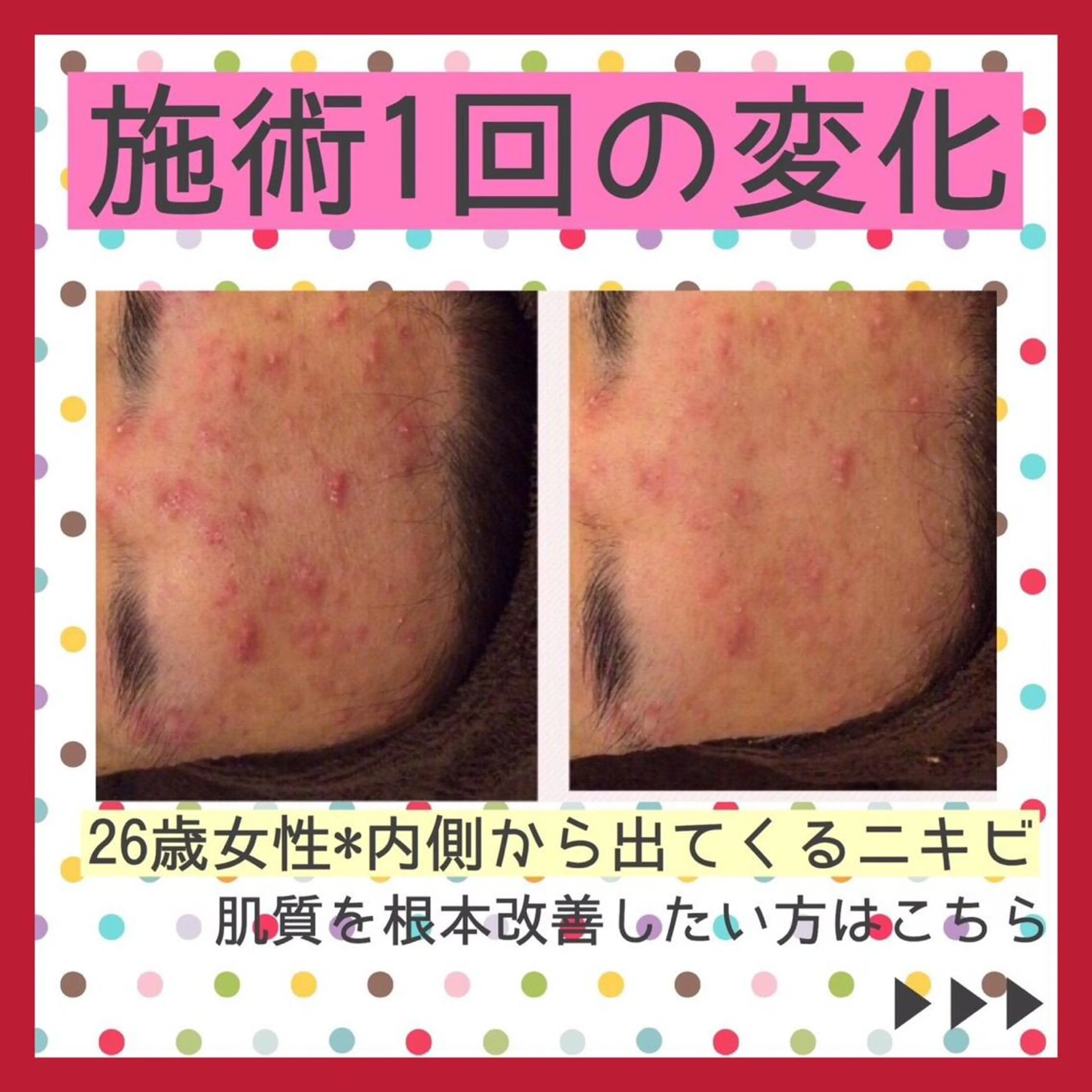 ミディアム カラー パーマ ヘアアレンジ メンズ キッズ ネイル マツエク・マツパ アイブロウ エステ リラク ニキビ・肌質改善専門 ♡人生が変わるサロンのエステ・リラクイメージ