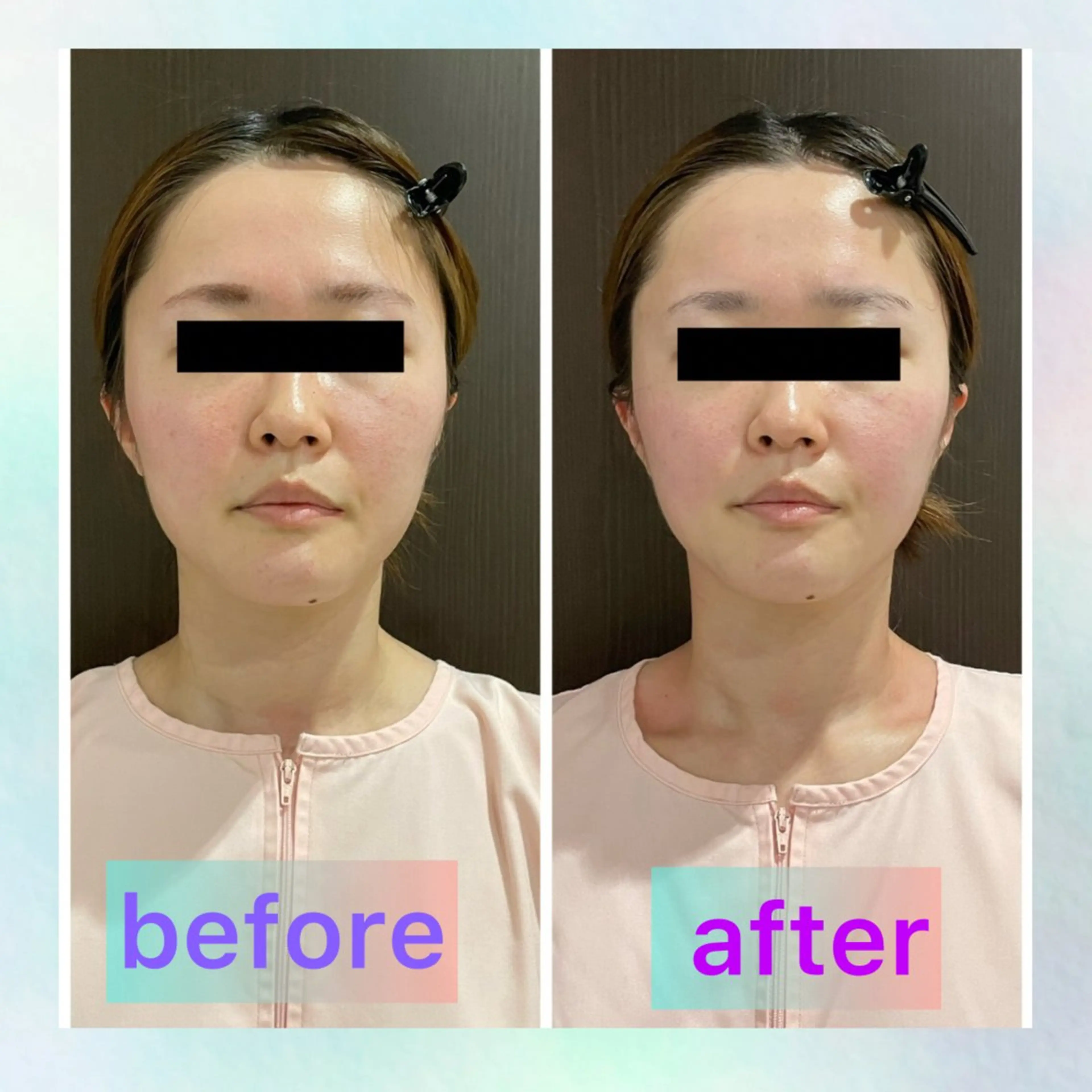 モニター価格‼️【人気No.１韓流コルギ】スッキリ小顔に！お顔の土台ケア　お一人様1回限り！の写真