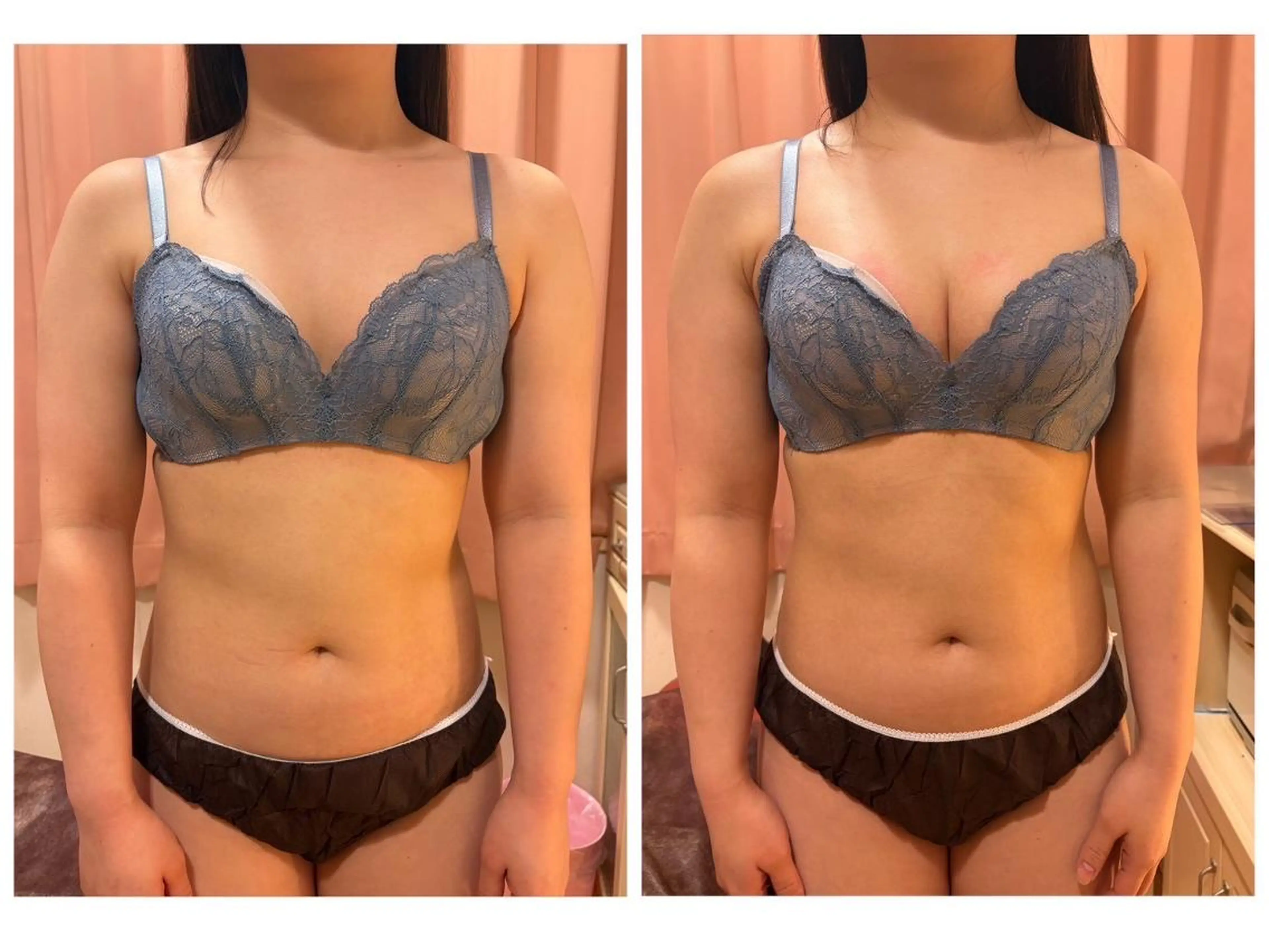 エステ リラク バスト専門店 RAYVIS🌺のエステ・リラクイメージ