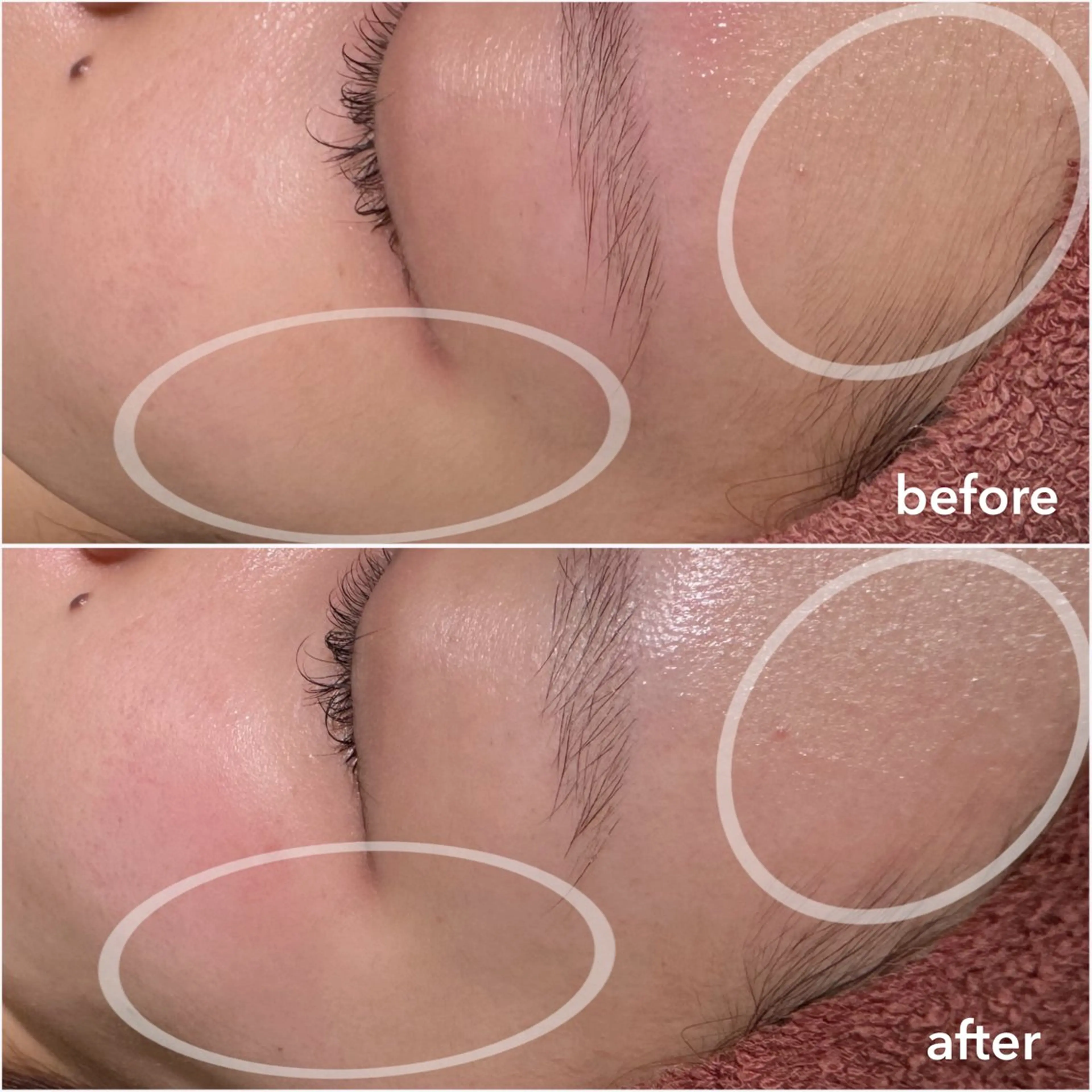 REVE （レーヴ）のマツエク・マツパデザイン