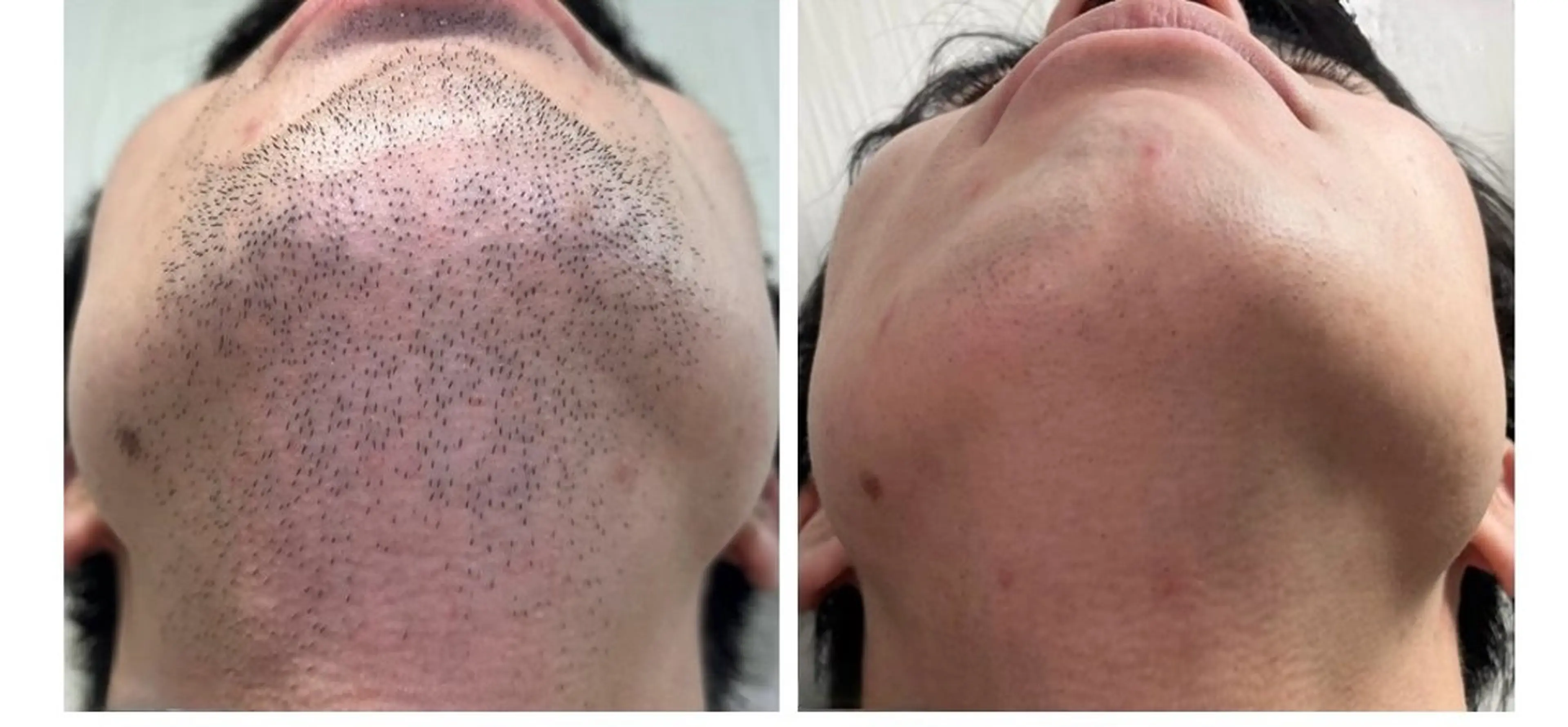 脱毛 RIKKA所属・RIKKA☆脱毛/ アイブロウ/メイクのエステ・リラクイメージ