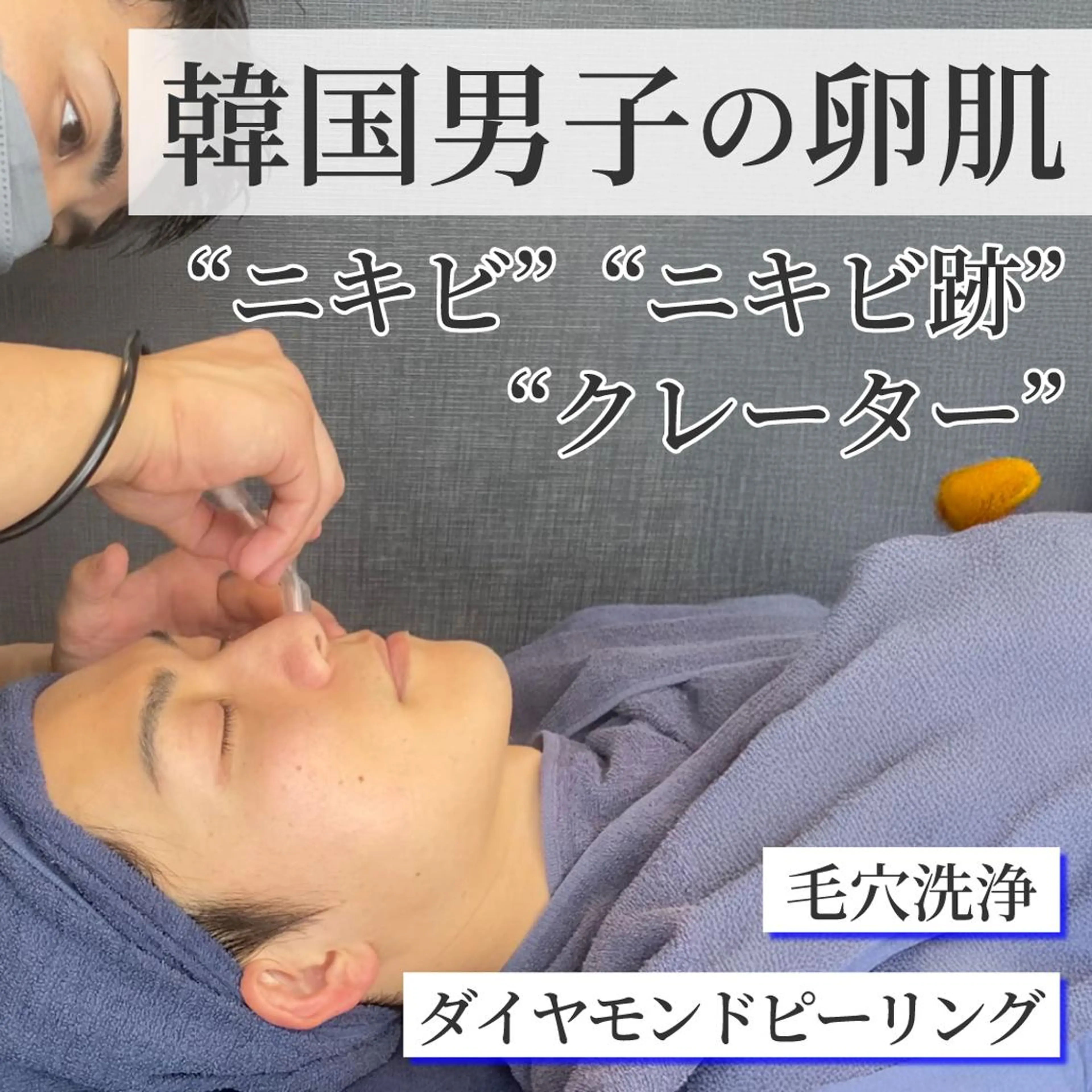 【メンズエステ】皮脂ごっそり毛穴洗浄×ピーリングでニキビケア×潤いパックの写真