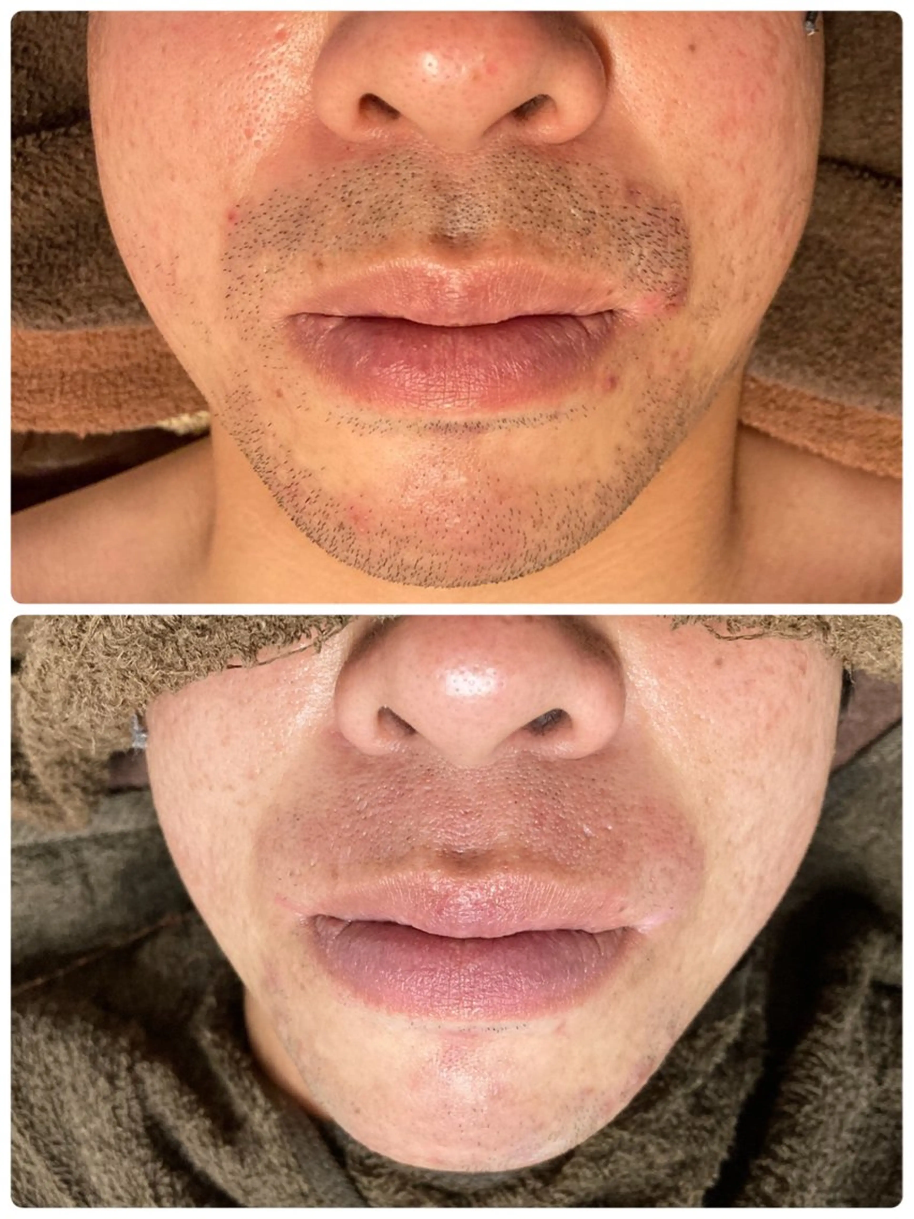 脱毛＆リラクエステA＊所属・脱毛&リラクエステ A*（アスター）のエステ・リラクイメージ