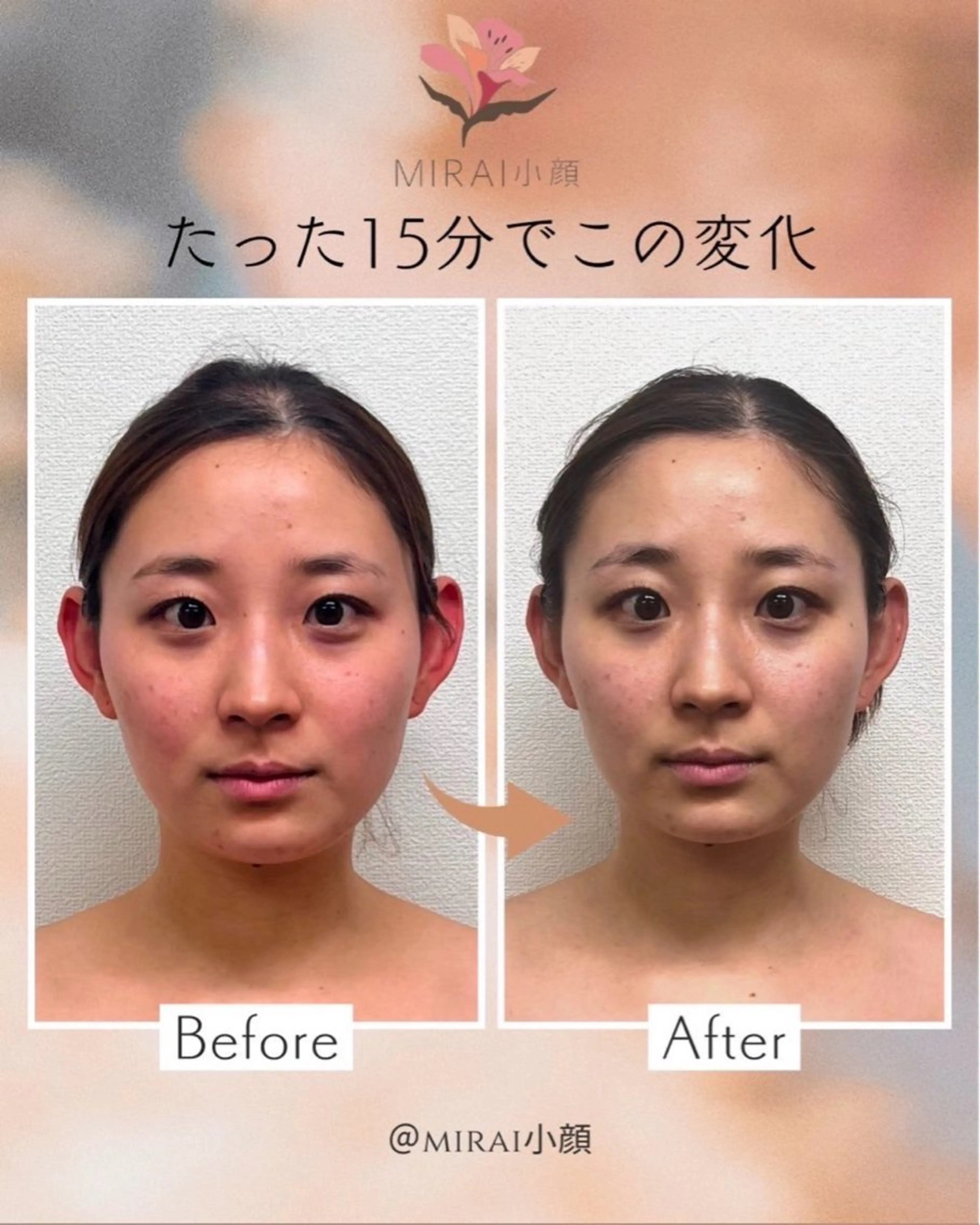 エステ MIRAI小顔 栄店のエステ・リラクイメージ