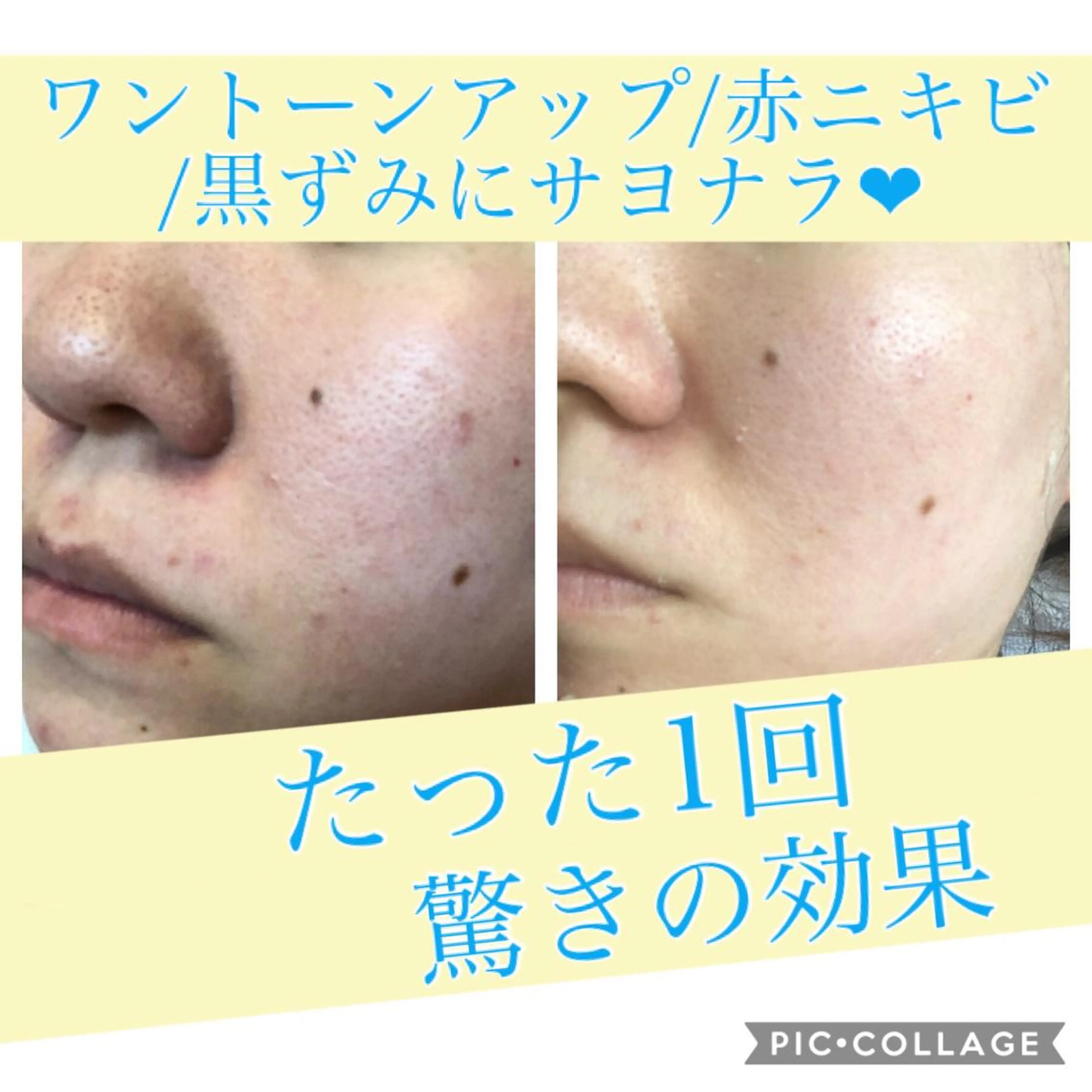 ロング カラー パーマ ヘアアレンジ キッズ ネイル マツエク・マツパ エステ リラク Ensor Clair所属・EnsorClair 代表 野口真央のエステ・リラクイメージ