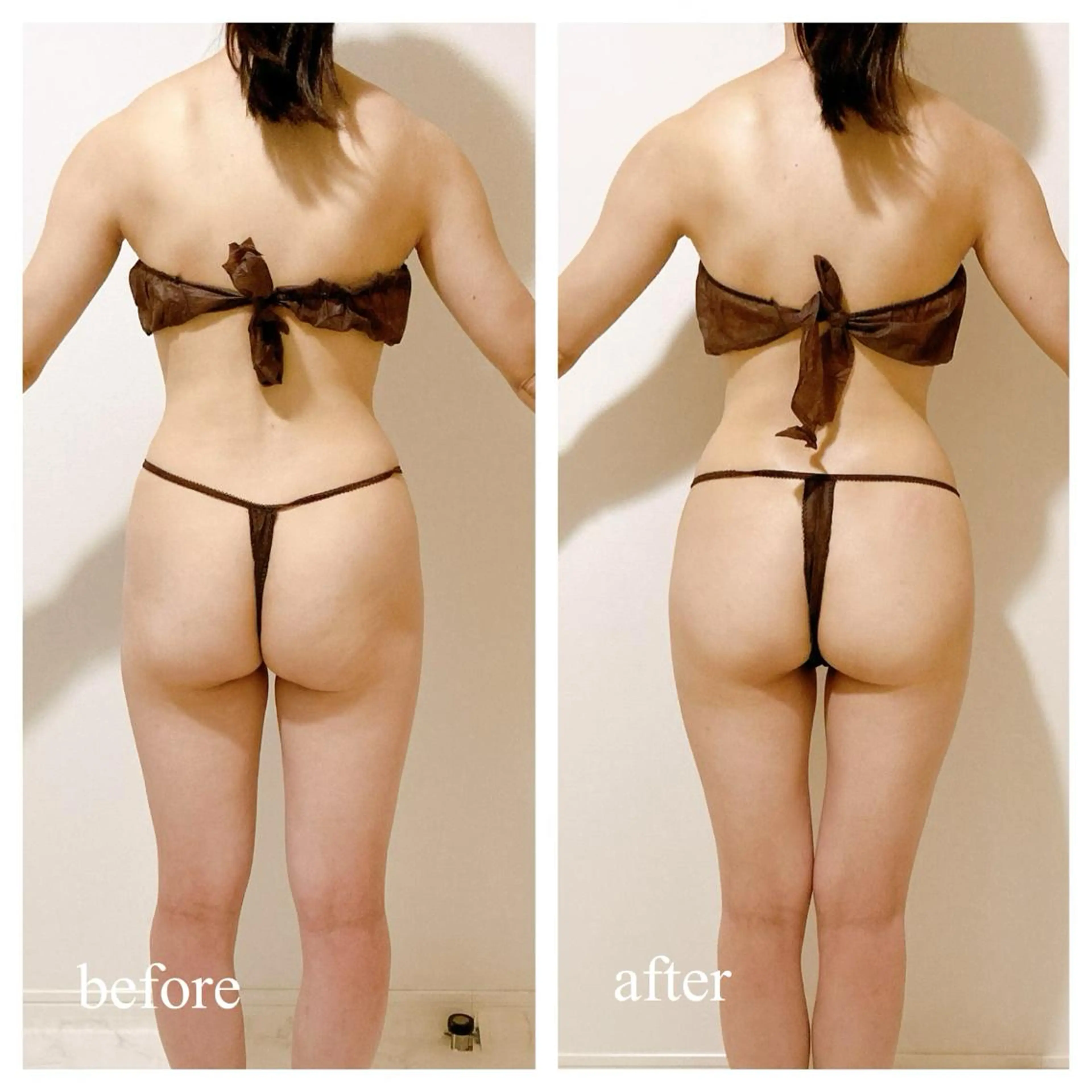 《姿勢改善&脂肪ケア》美容整体60分+痩身機械20分(2部位)【リニューアル特別価格♪】気になるセルライトをケア🔥🔥の写真