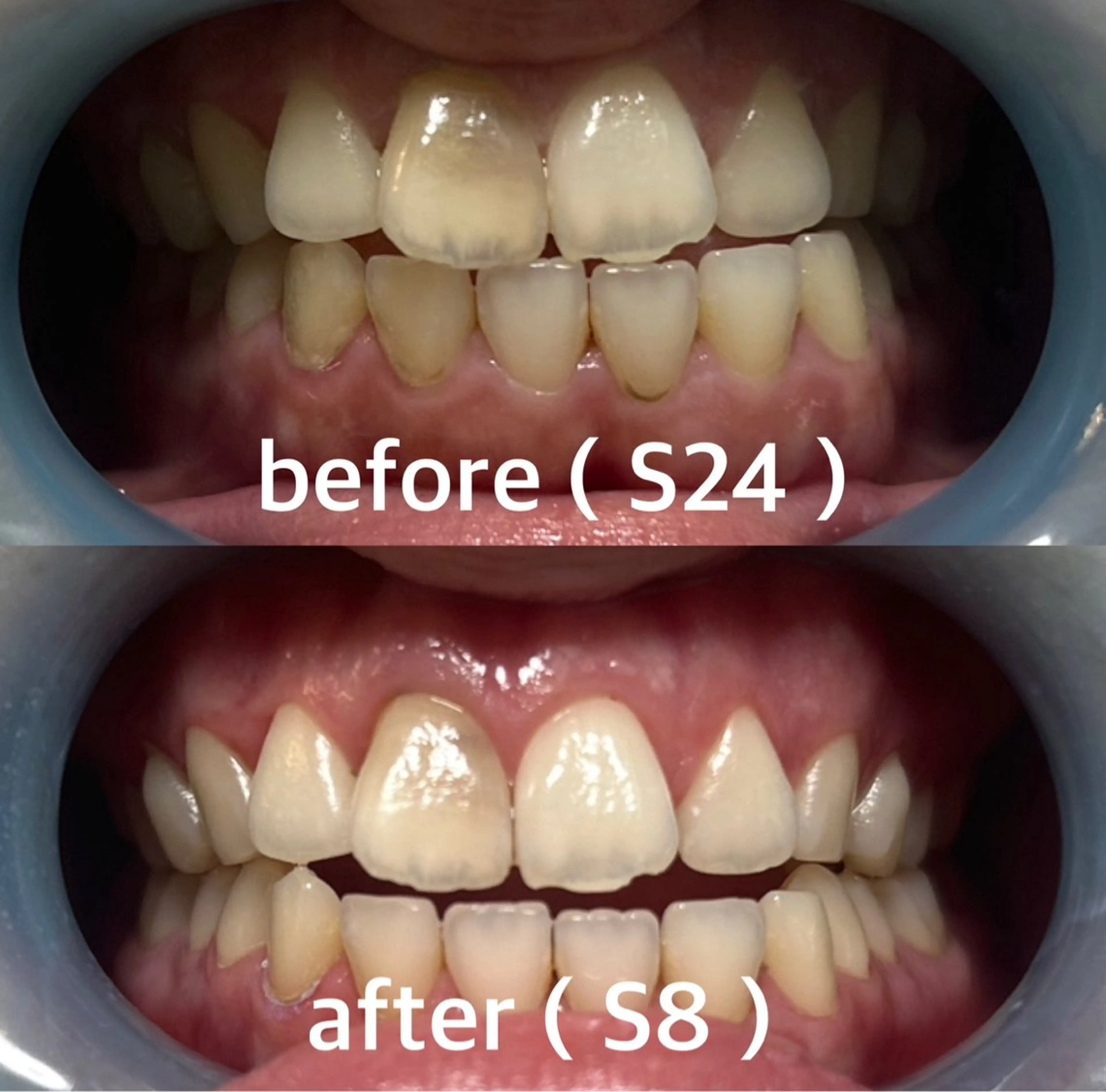 九州オーラルホワイトニング所属・田中 毬亜/薬院警固店のエステ・リラクイメージ