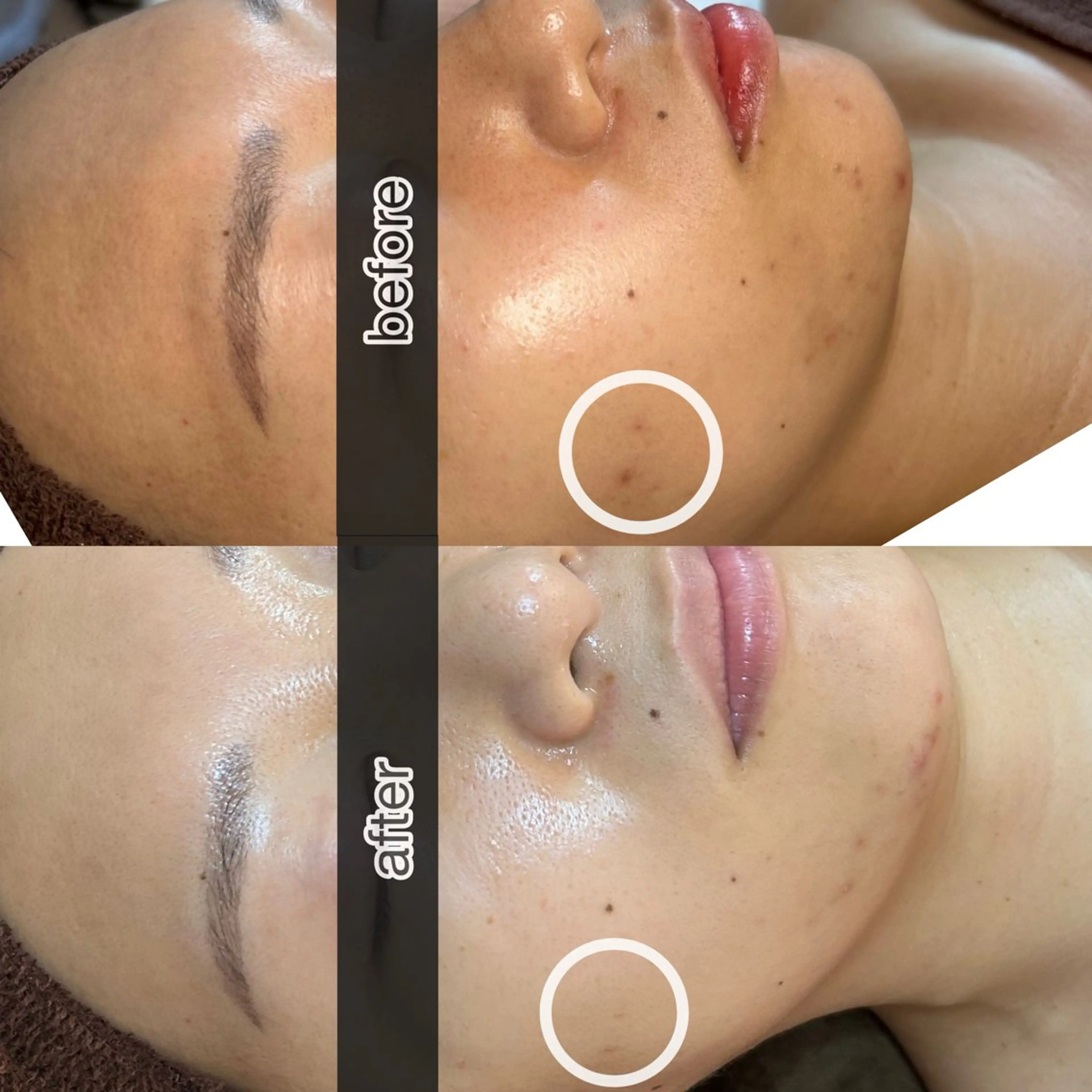 エステ 四ツ橋フェイシャル Rebornのエステ・リラクイメージ