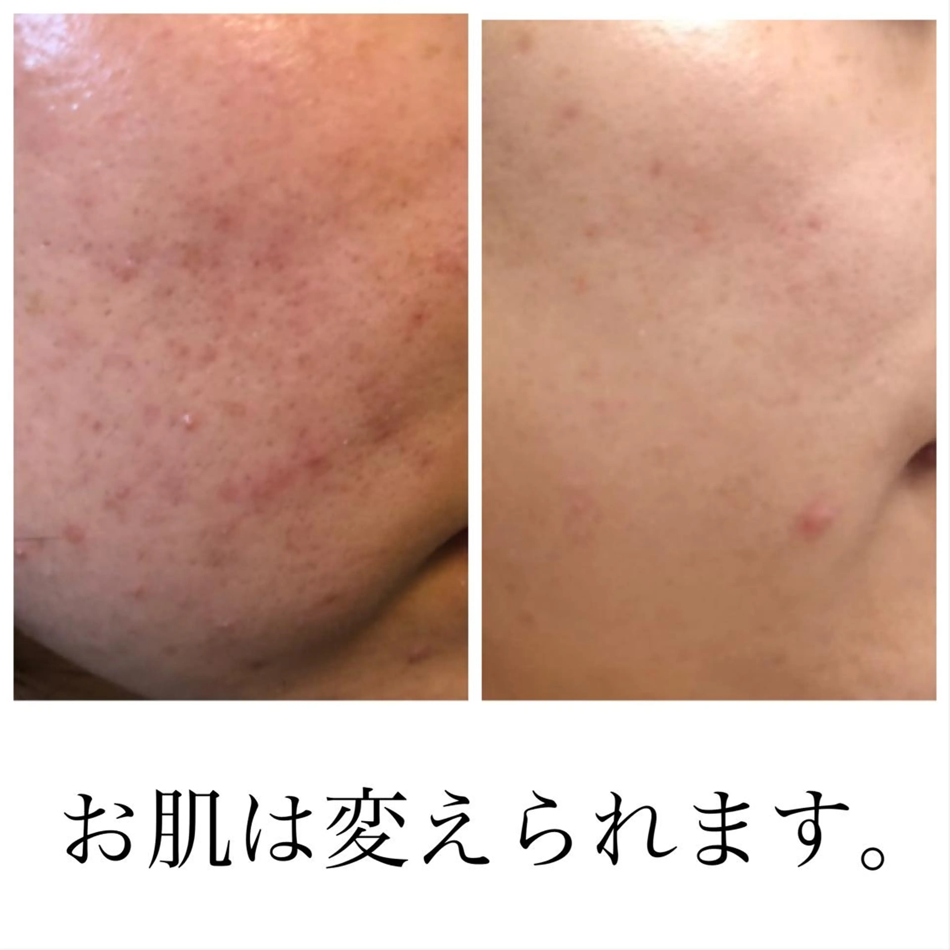 CEサロンblanc bebe所属・高村 有紀のエステ・リラクイメージ