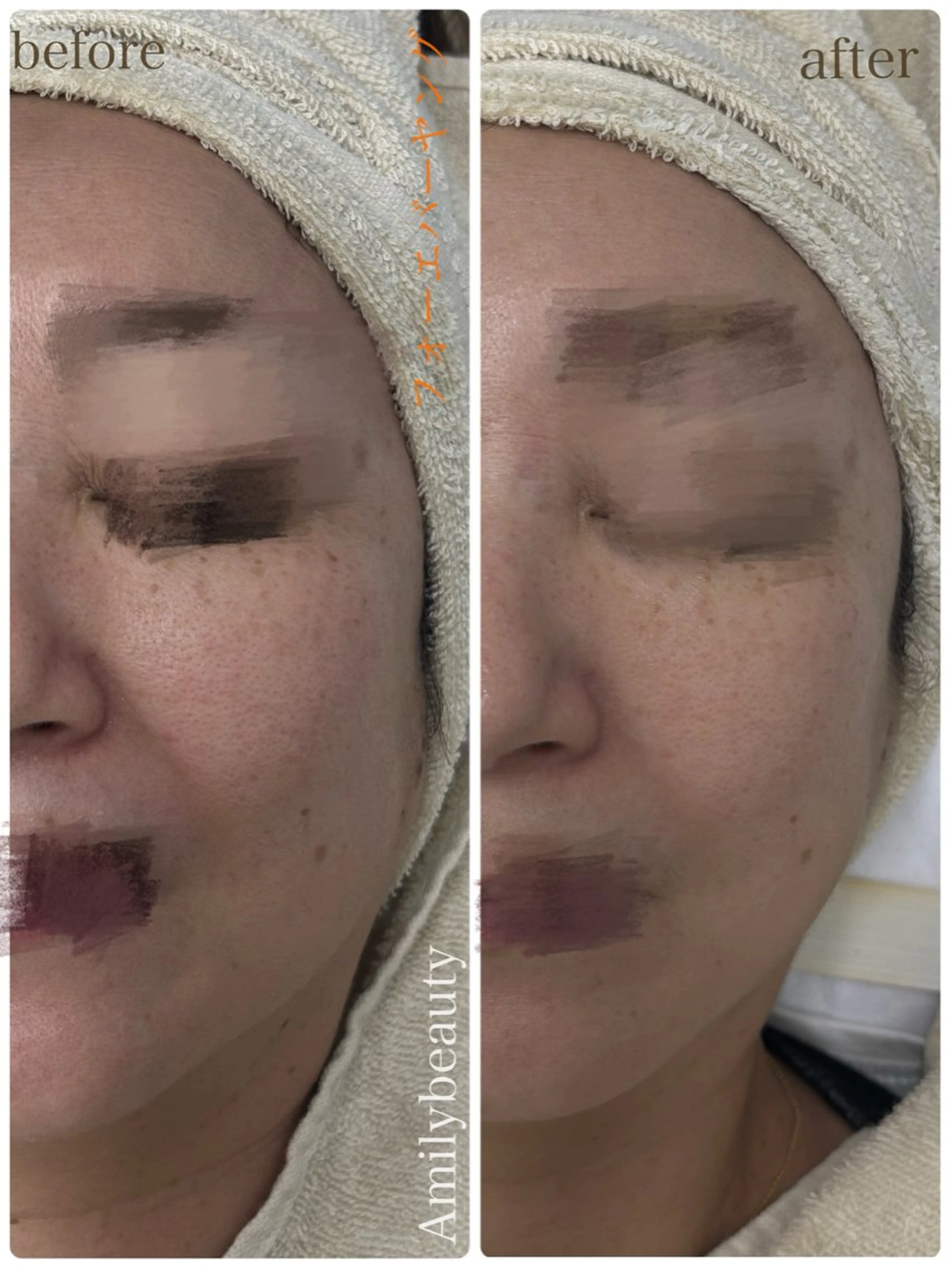 エステ Amilybeauty所属・Amily beauty 毛利のその他イメージ