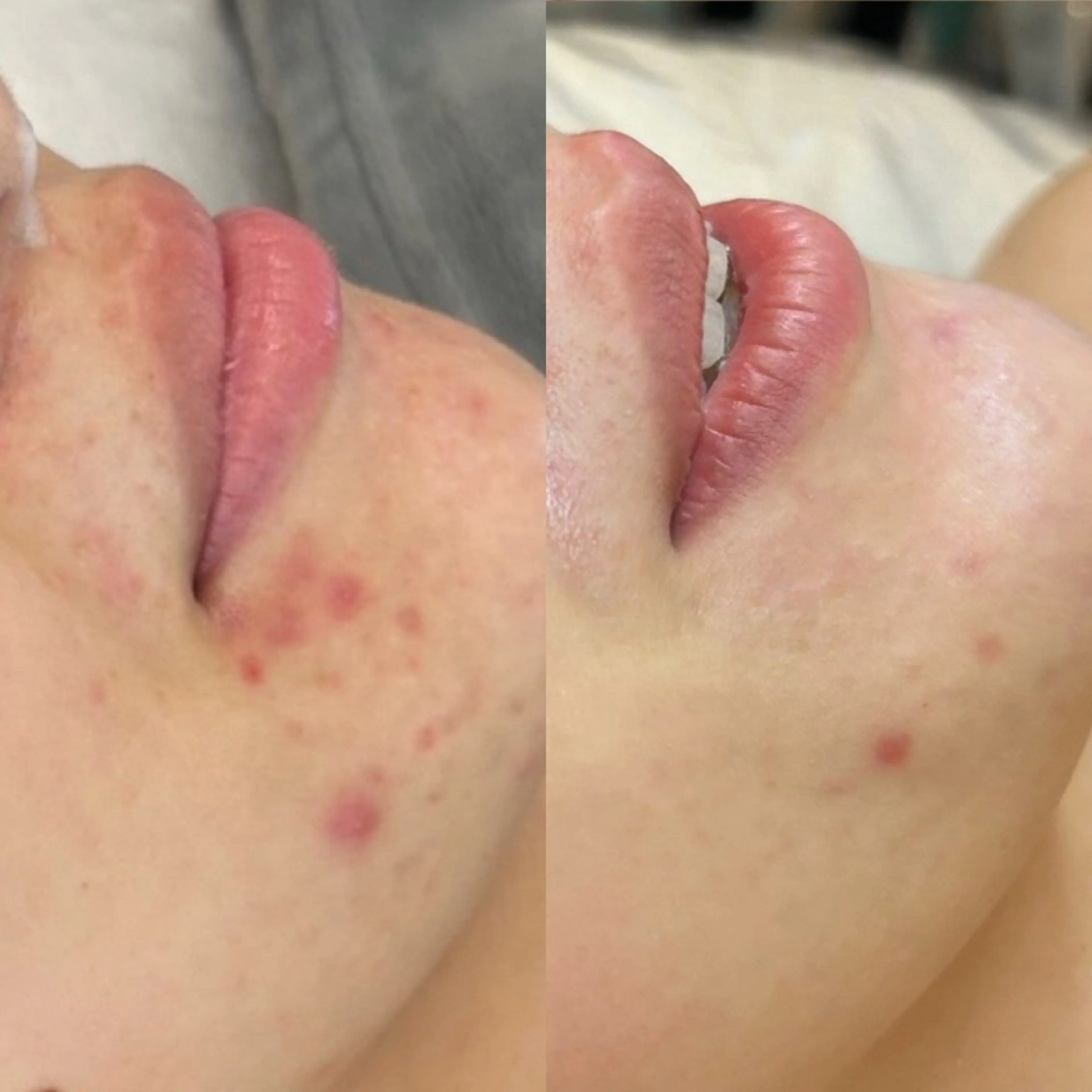 韓国🇰🇷価格 サロン_Nbibiのエステ・リラクイメージ