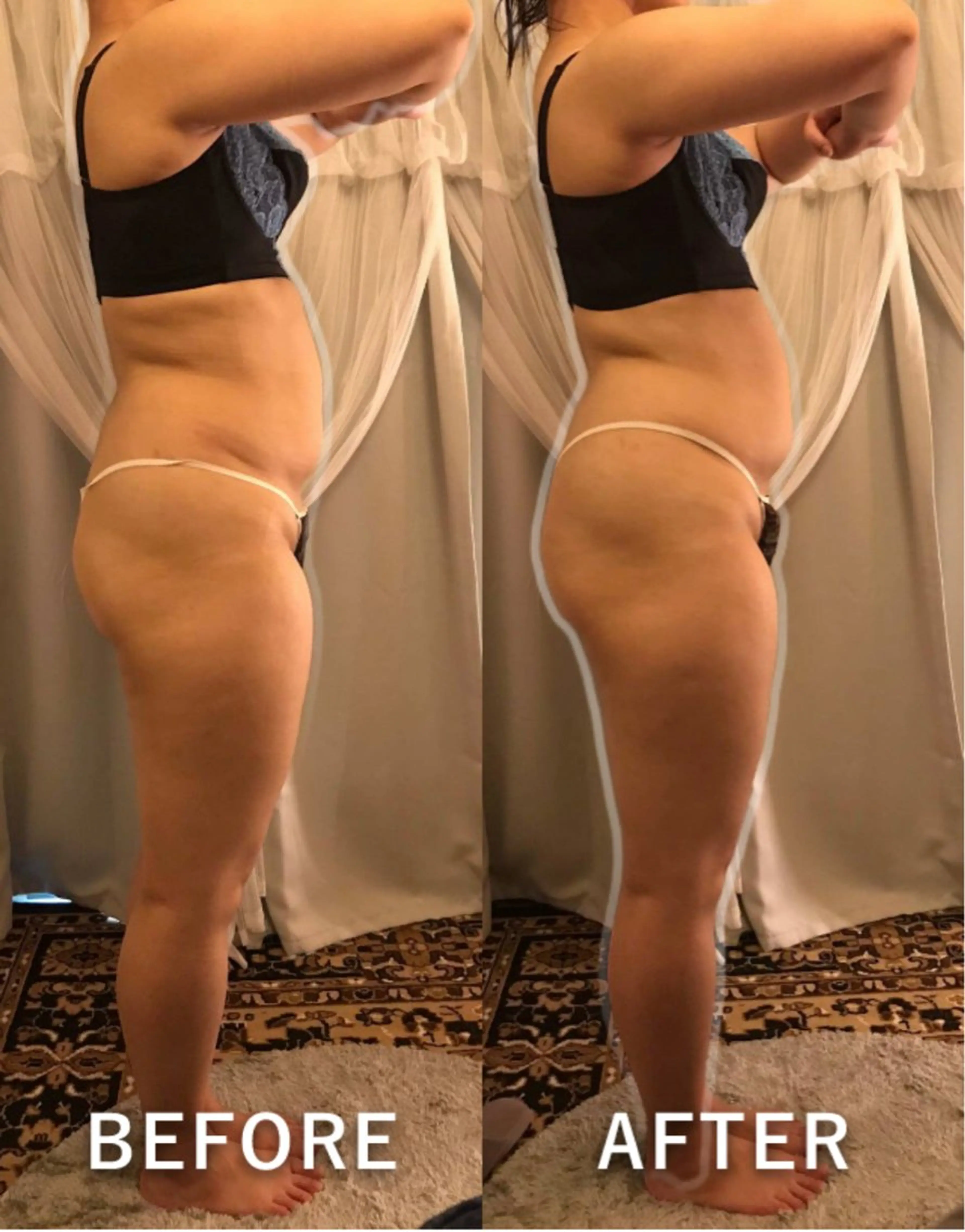 【極楽氣分のダイエット施術体験】1回目から引き締まる.引き上がる！？内臓下垂へのアプローチ・極楽筋膜リリース・排出体質への写真