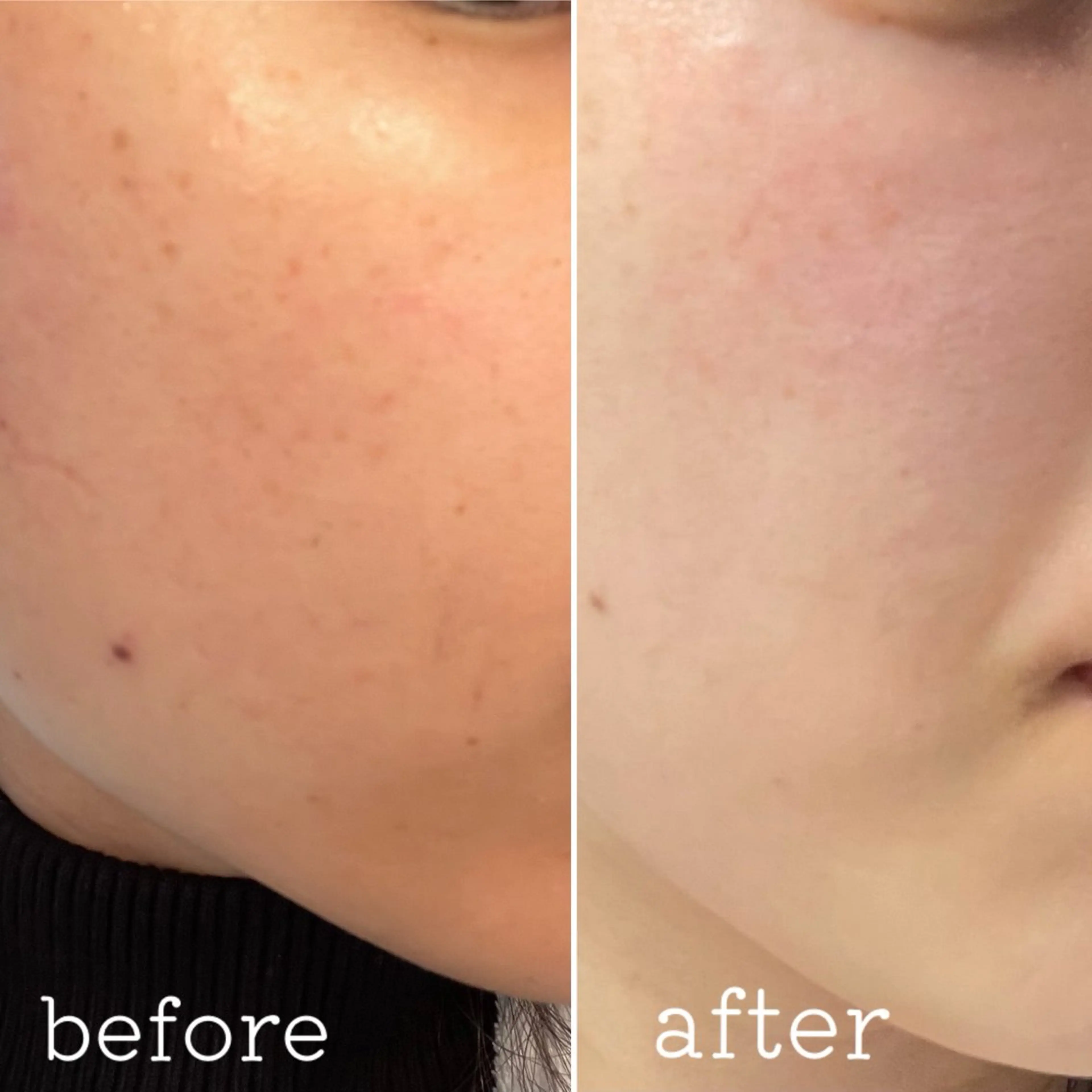 エステ private saloneclatのその他イメージ