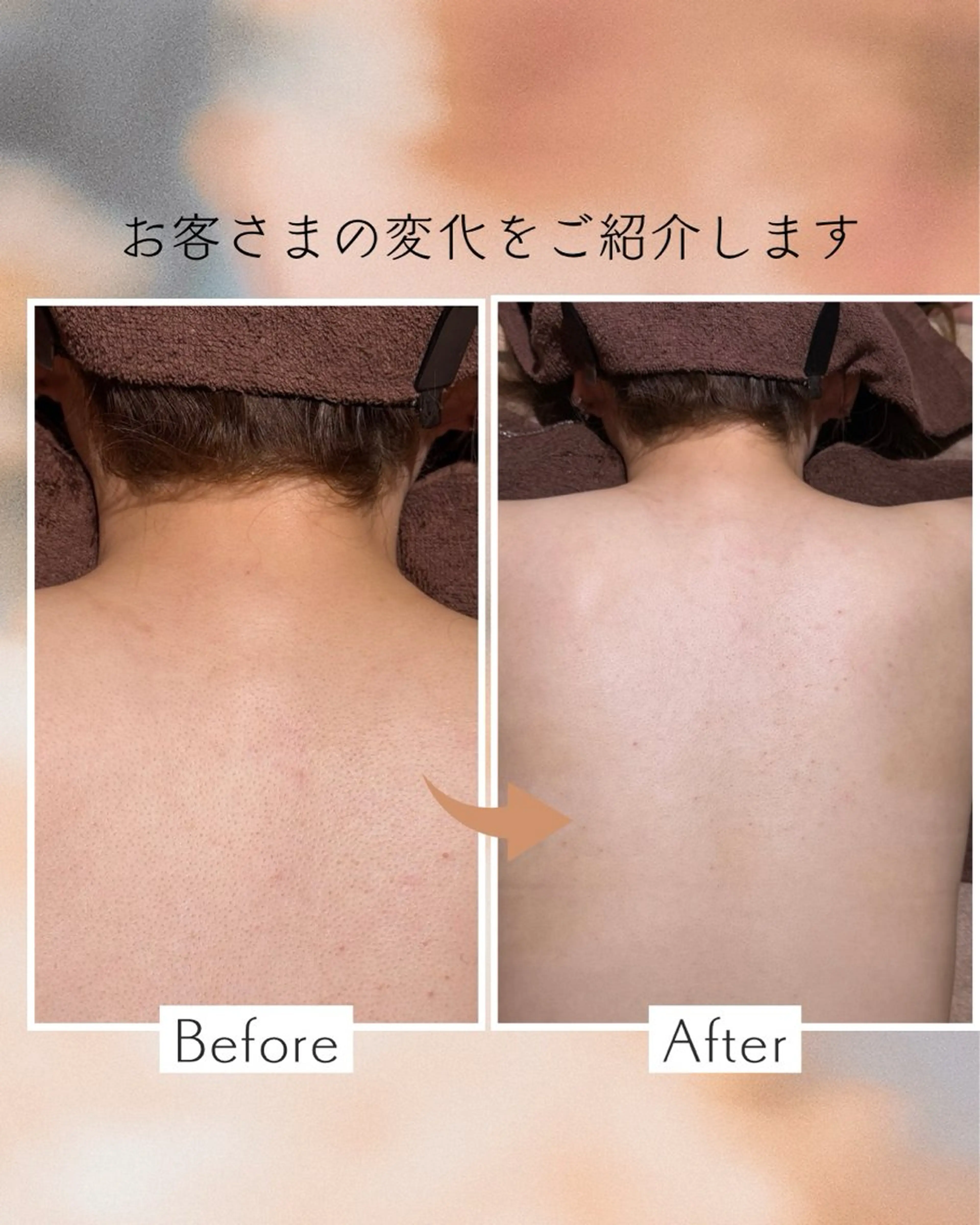 脱毛 下赤塚 ベルミーランドのエステ・リラクイメージ