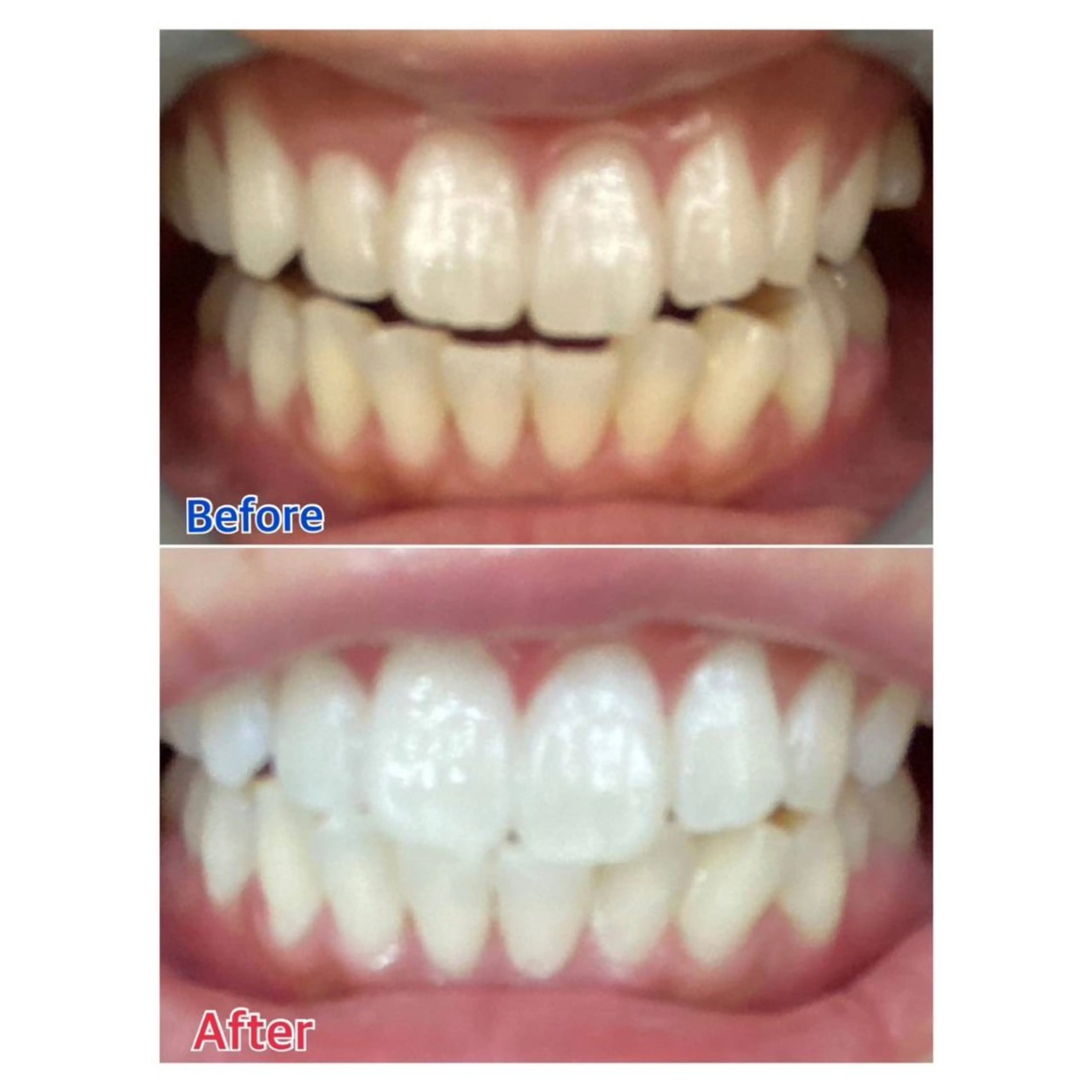 MBEAUTYSALON 千葉店・京成大久保所属・Melty 輝のその他イメージ