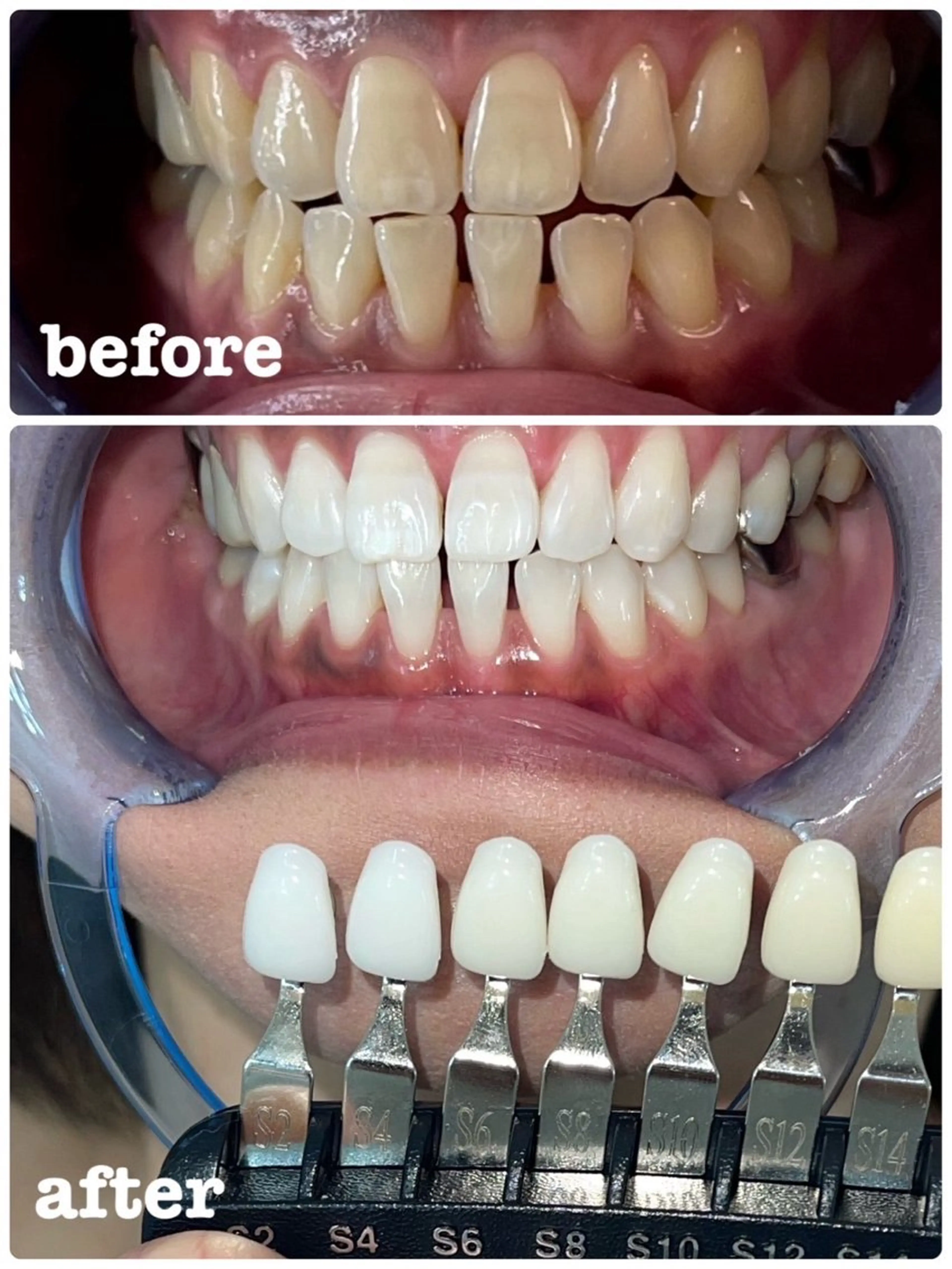 セルフホワイトニング エクシア徳島店マユのその他イメージ