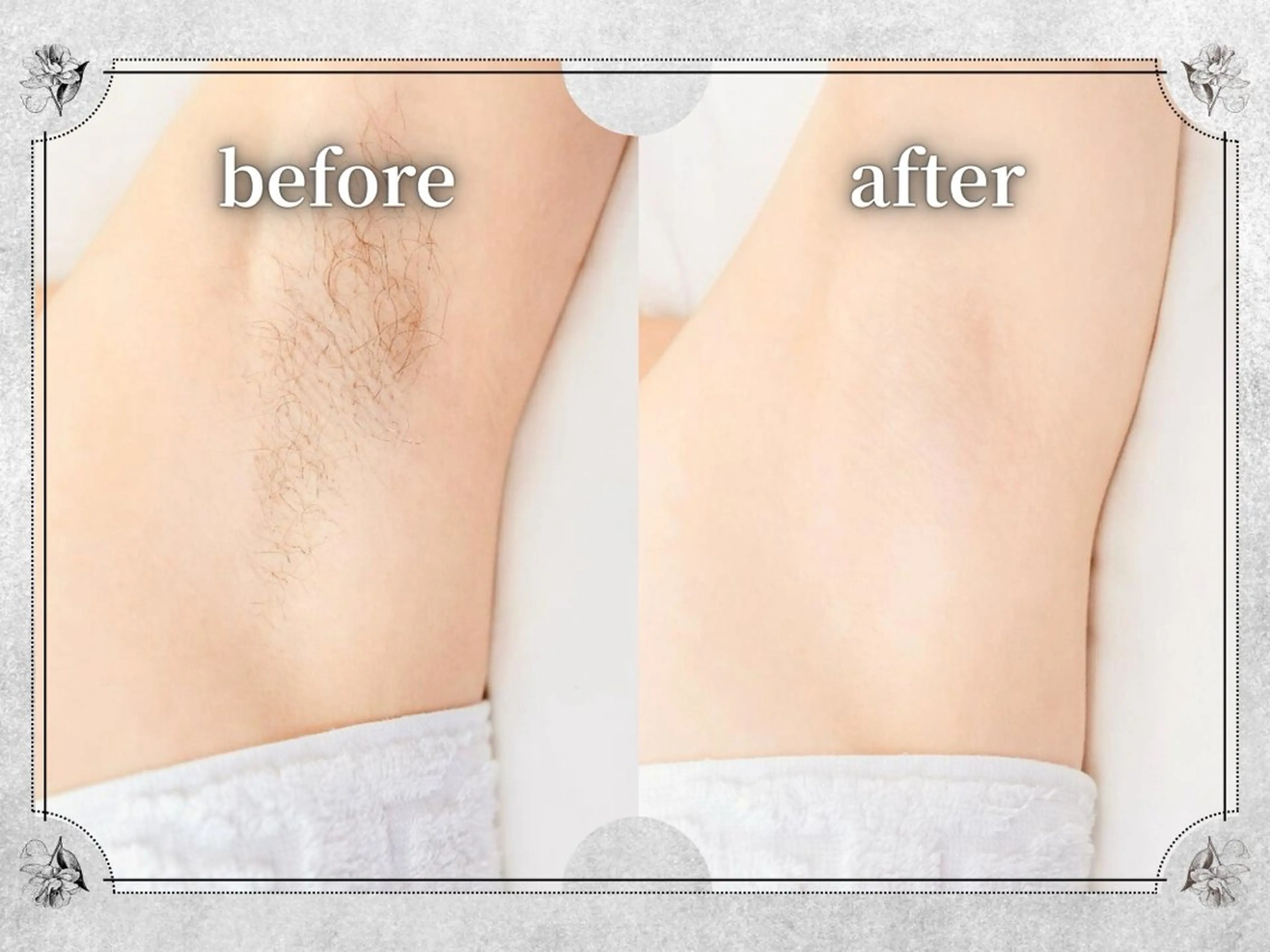 Lino by MIRA/Yuinaのエステ・リラクイメージ