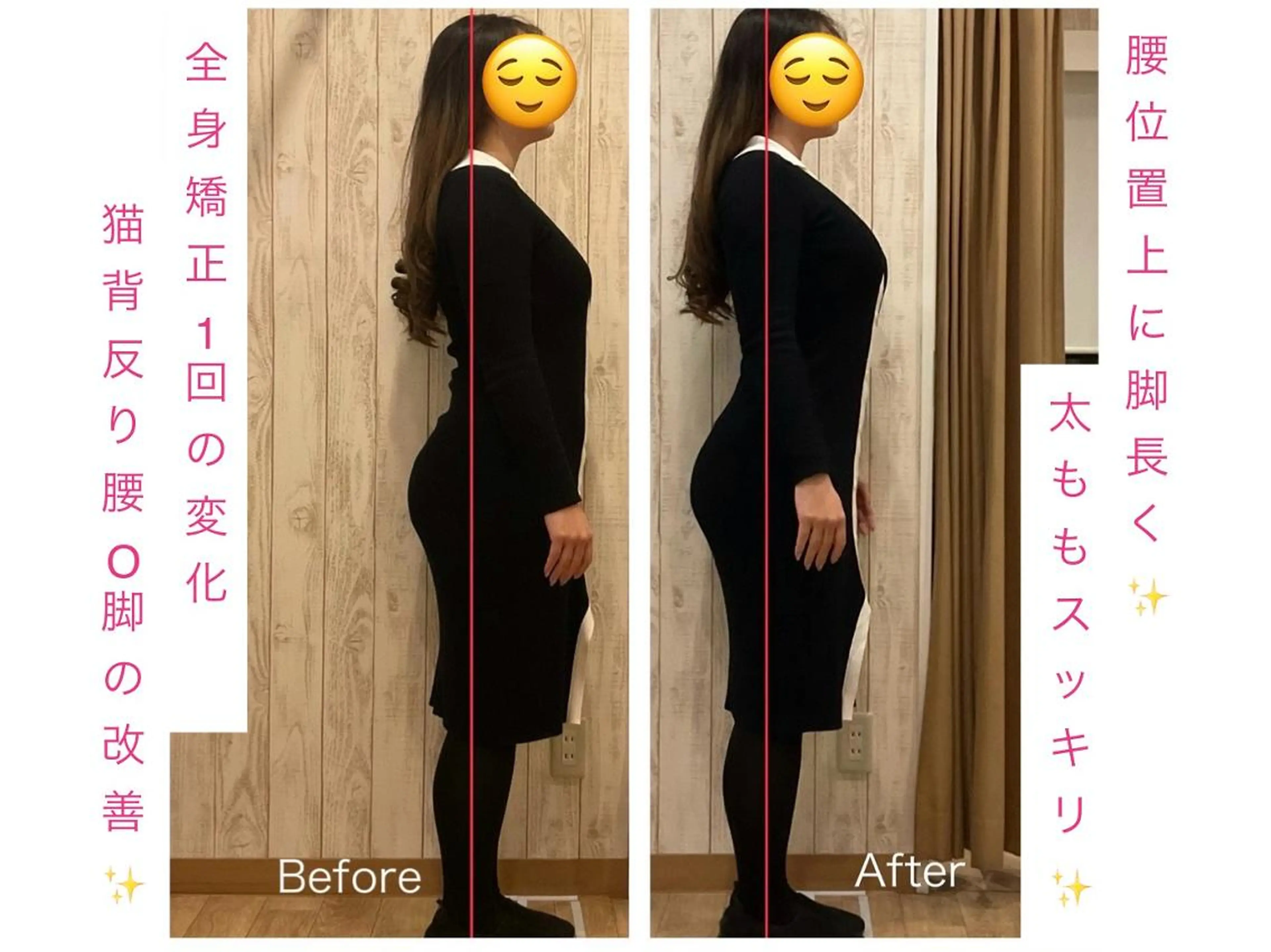 小顔矯正 natsuのエステ・リラクイメージ