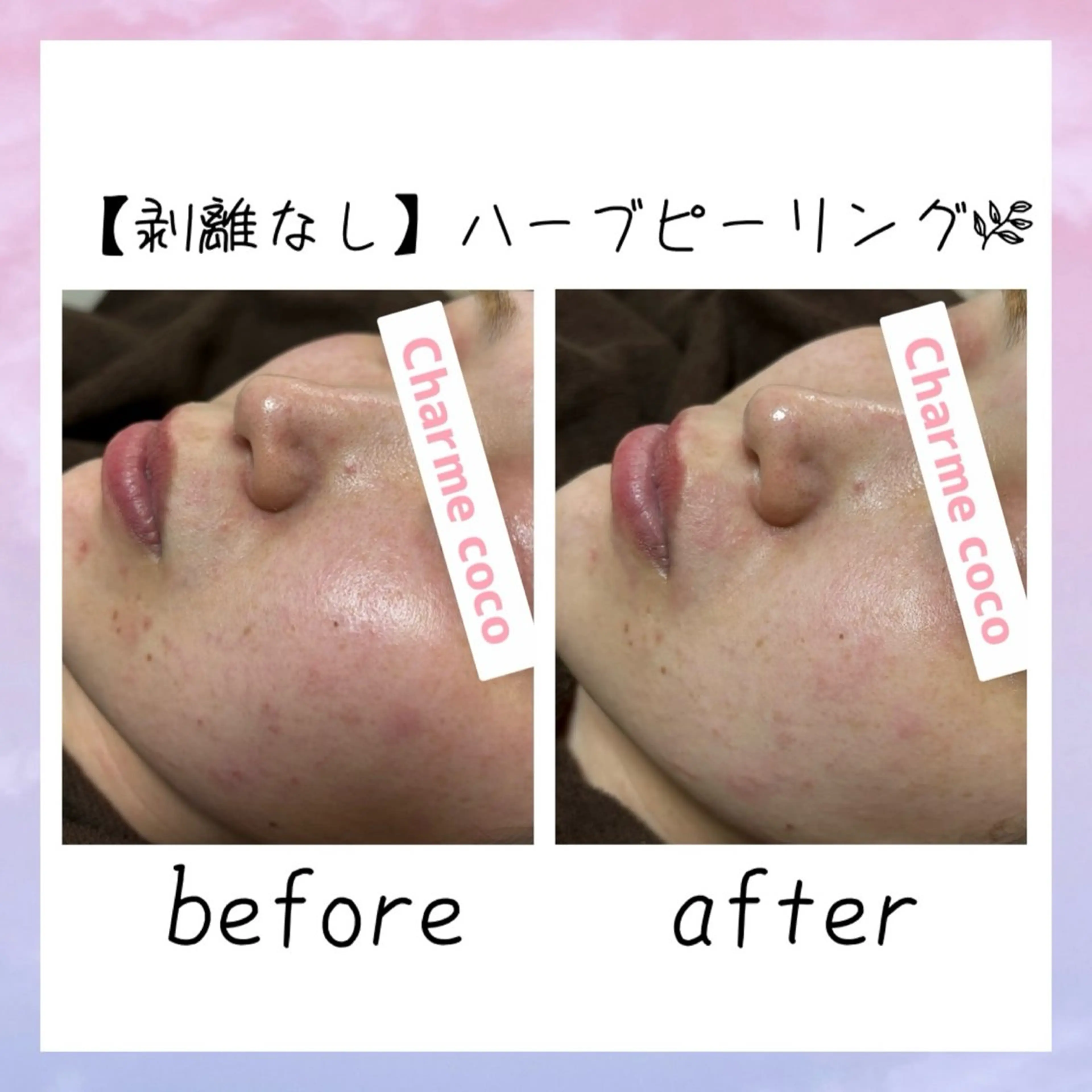 肌質改善Charme coco  増毛のエステ・リラクイメージ