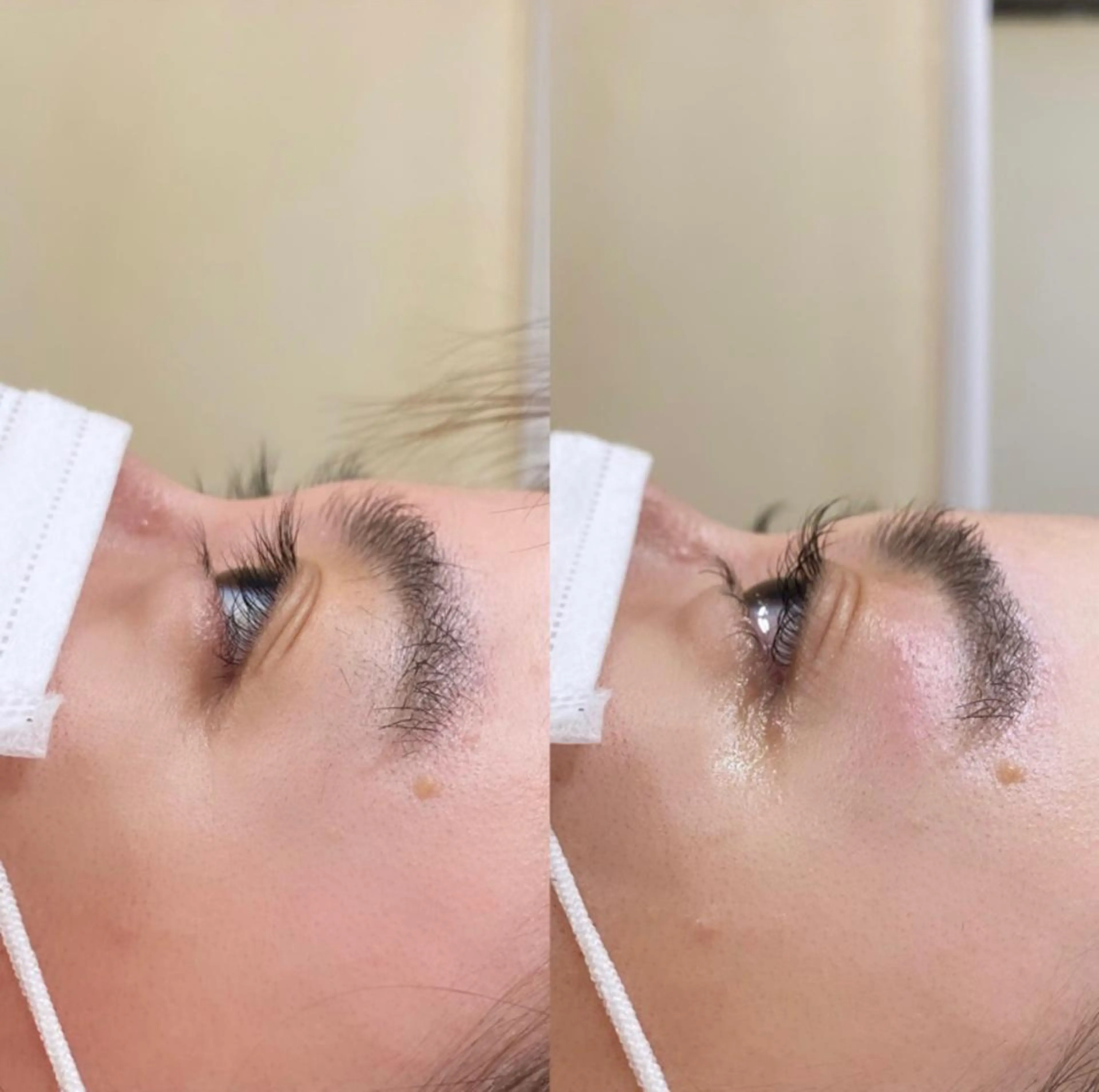 マツエク・マツパ Cカール 下まつげエクステ 一重×まつ毛パーマ chiri／似合わせ ／まつげパーマ／立川のマツエク・マツパデザイン