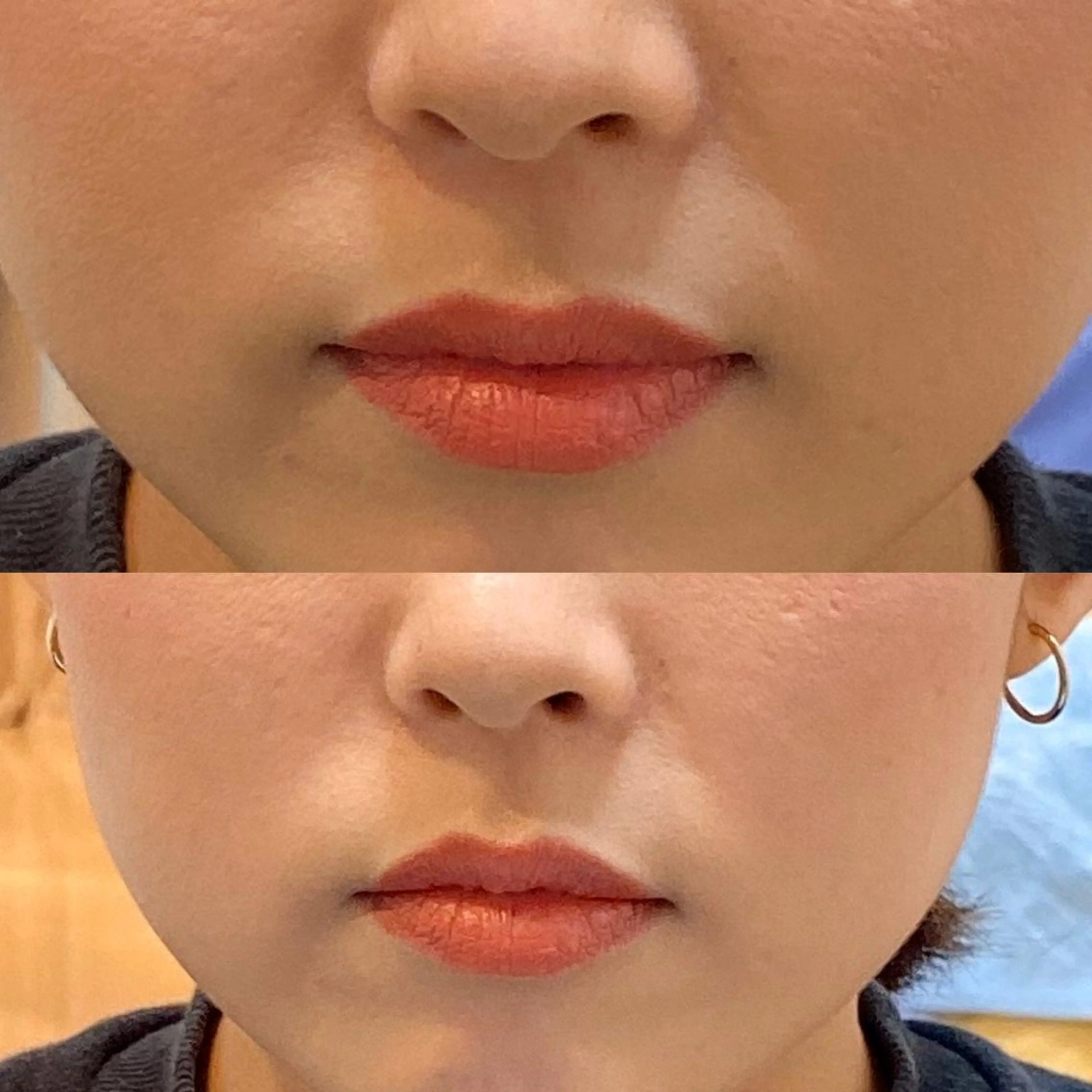 鍼灸整体院　蕾所属・美容鍼 蕾【谷町六丁目】のエステ・リラクイメージ