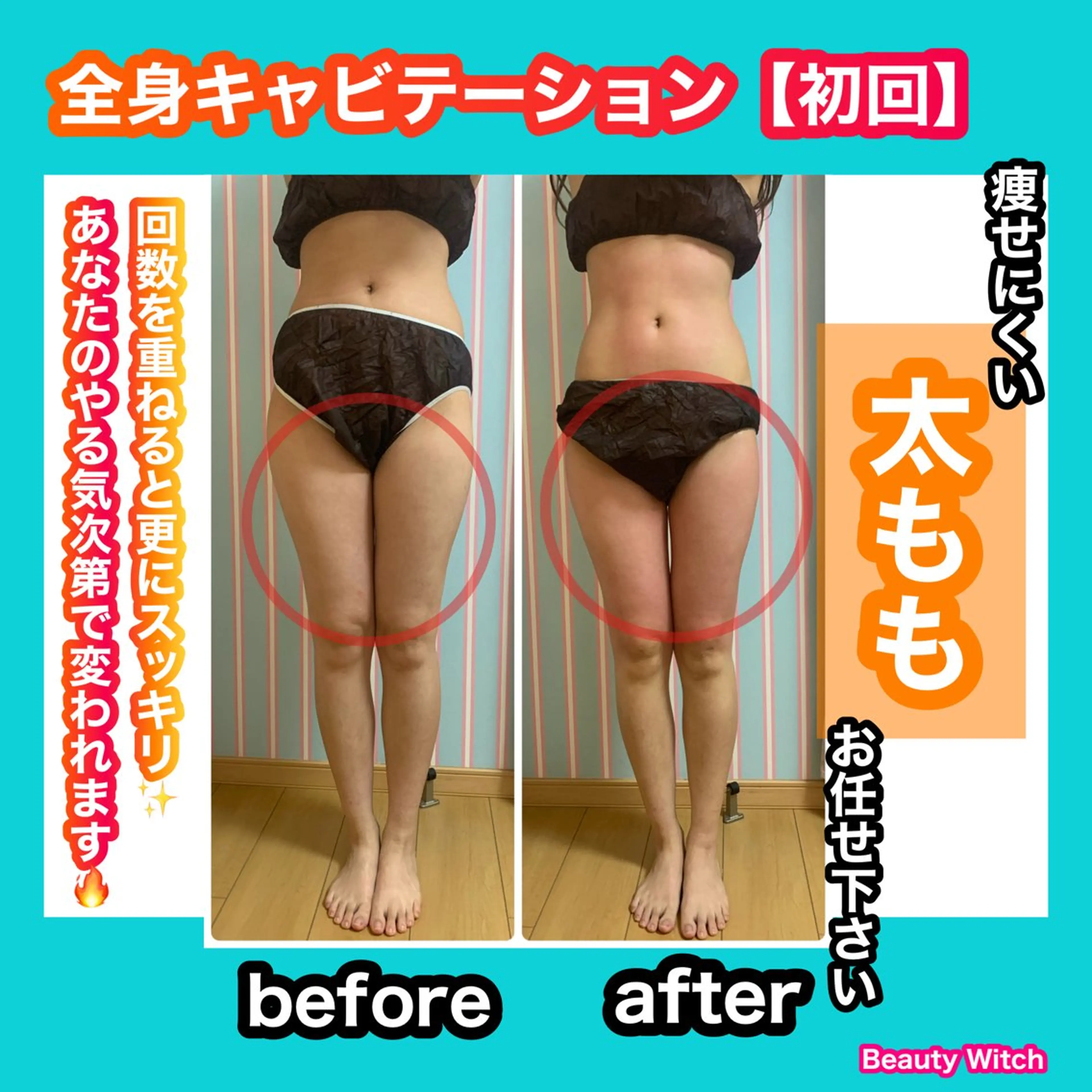 エステ リラク 痩身/脱毛/ネイル HARUKAのエステ・リラクイメージ