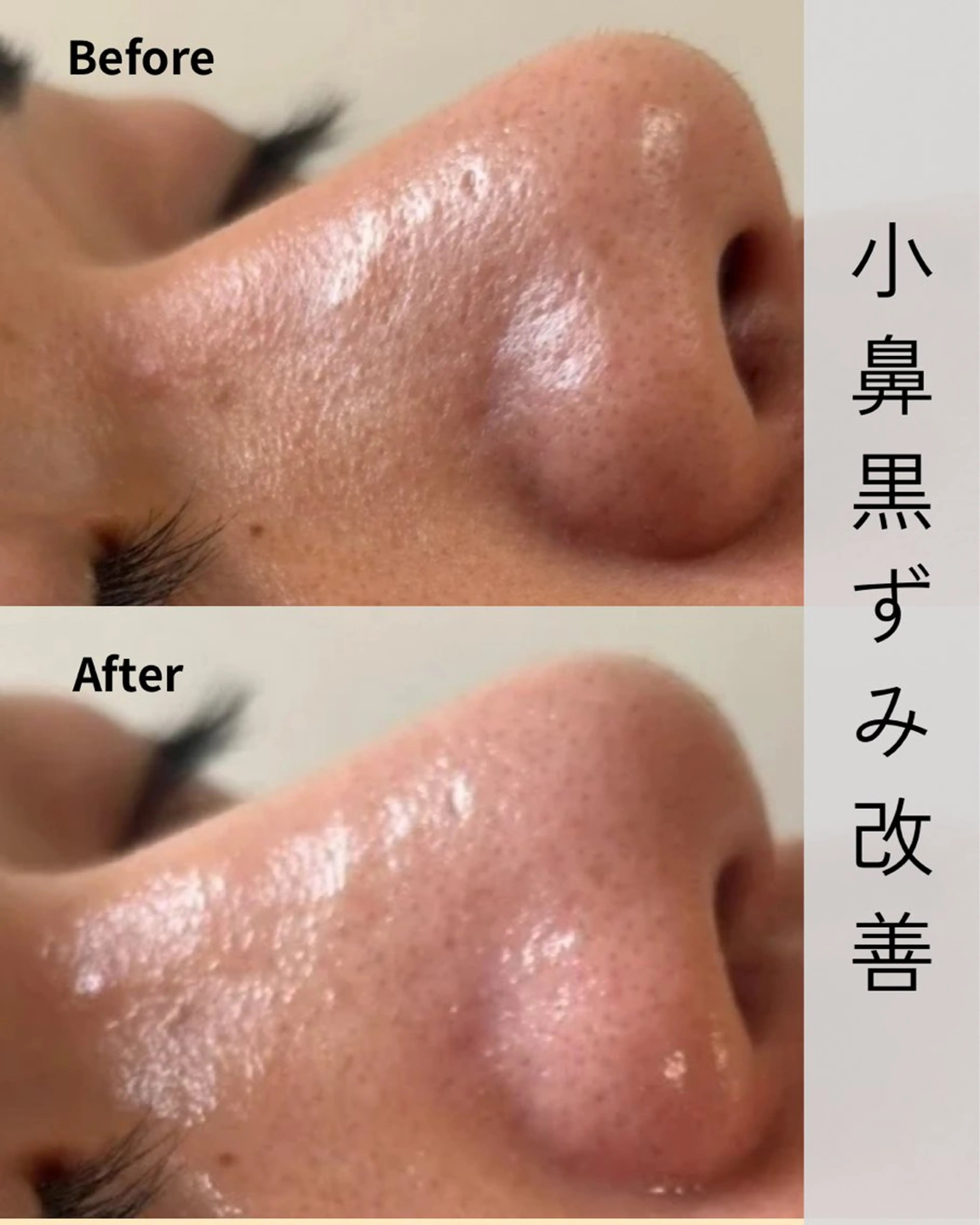 エステ Novelle所属・nozomi.m🌷 narisのエステ・リラクイメージ