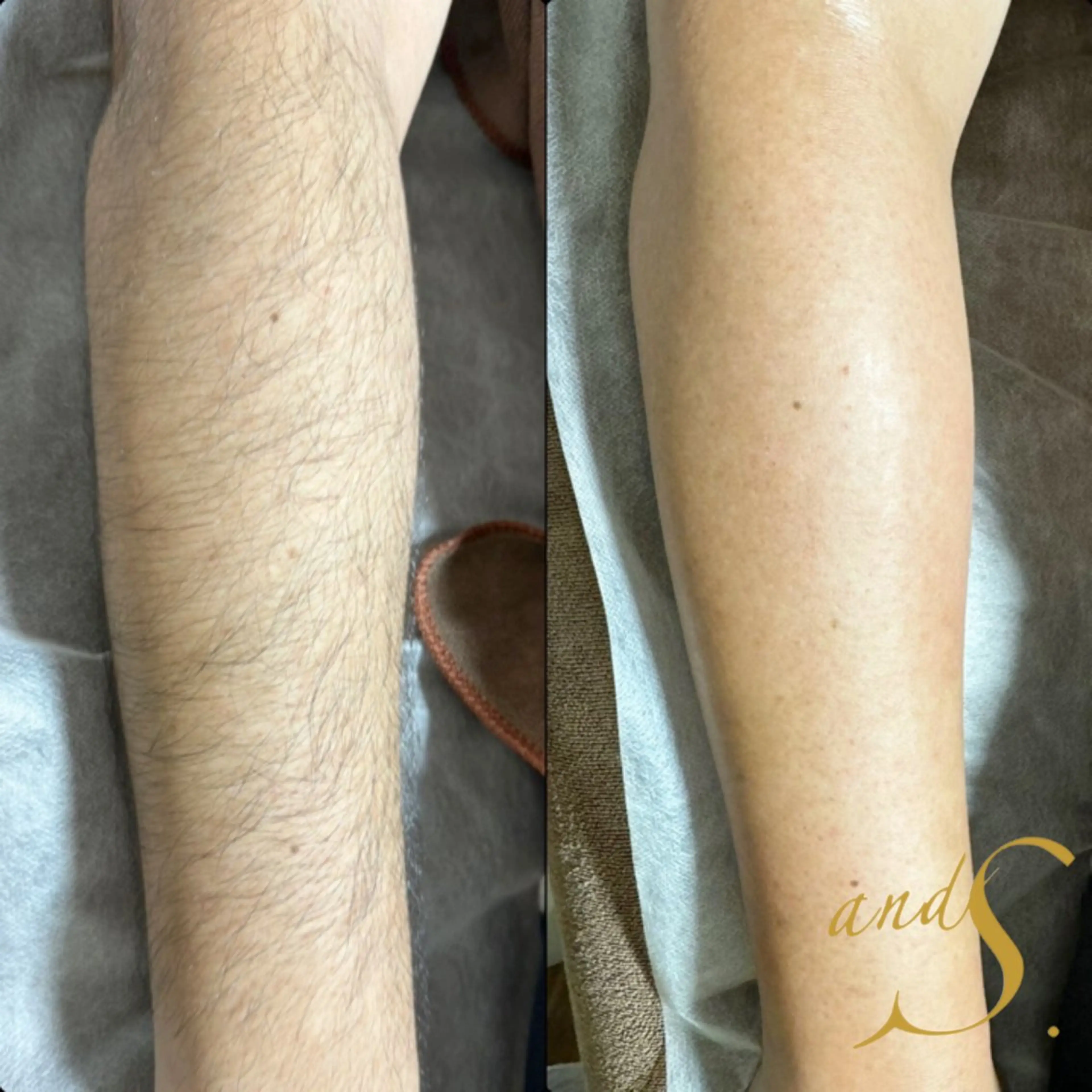 メンズ 脱毛 🌸🧡六本木 脱毛しずか🧡🫧の眉毛・アイブロウイメージ