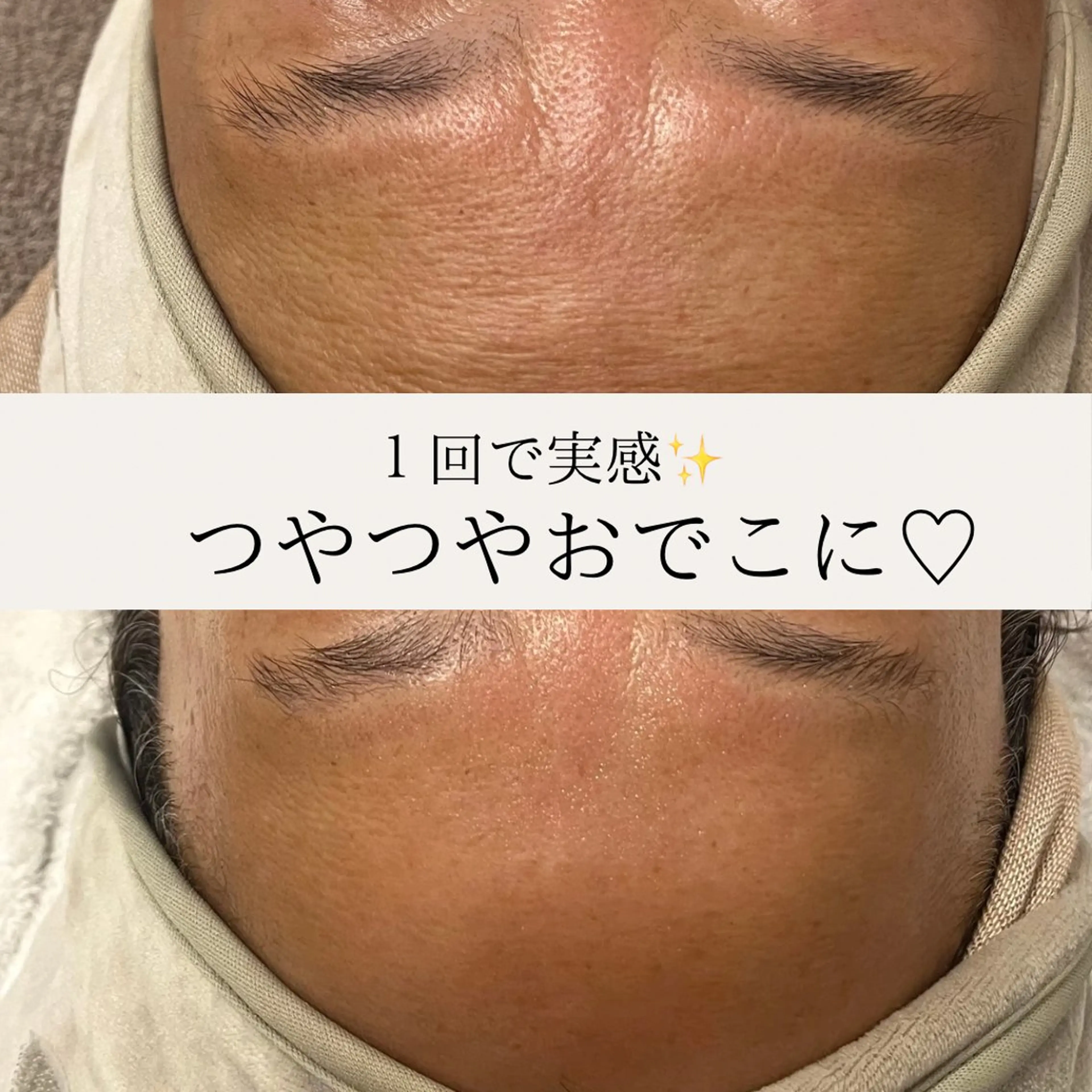 Total Beauty salon Bloom所属・肌育WISHpro 専門サロンBloomのエステ・リラクイメージ