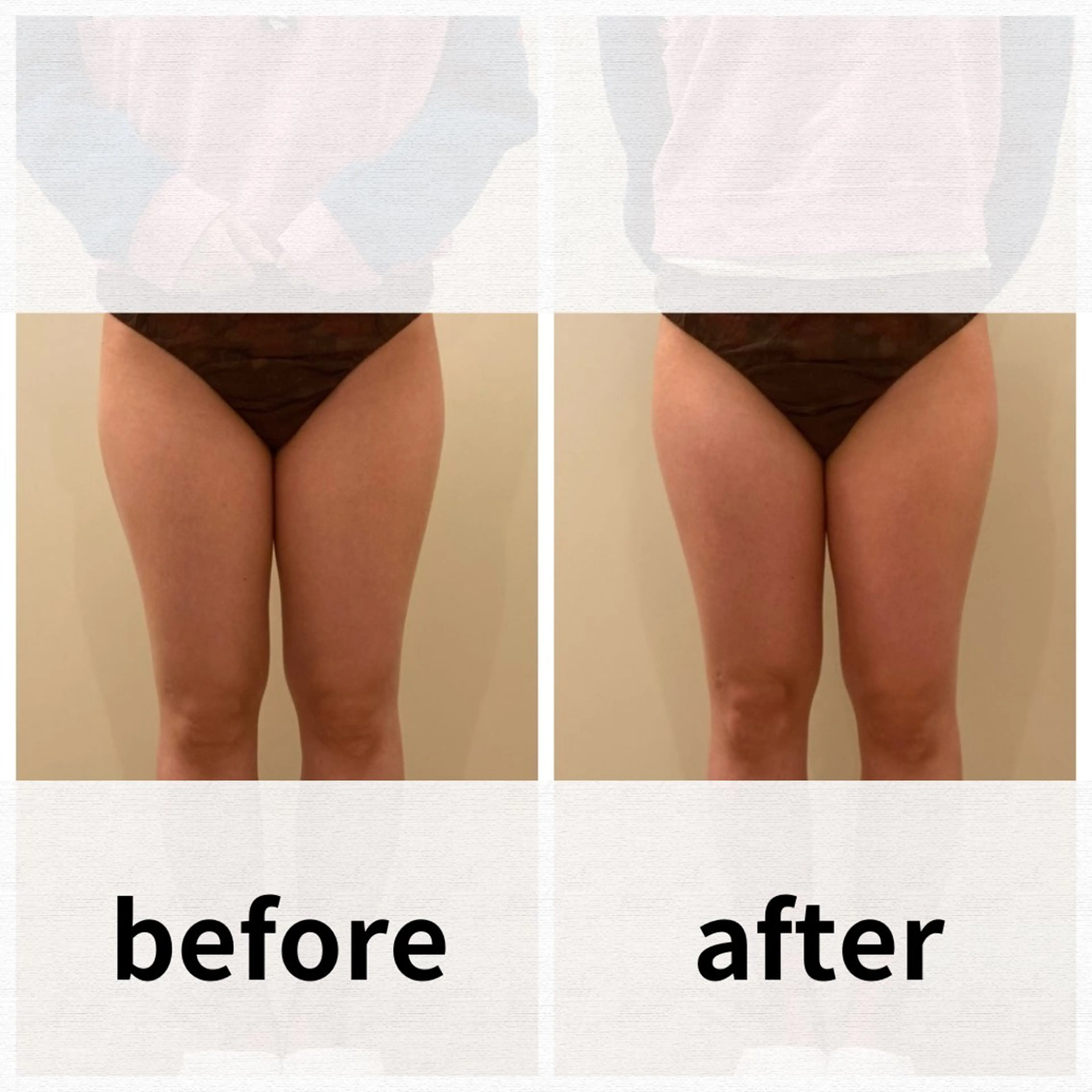 美容鍼/ヘッドスパ/ 💎さかもとのエステ・リラクイメージ